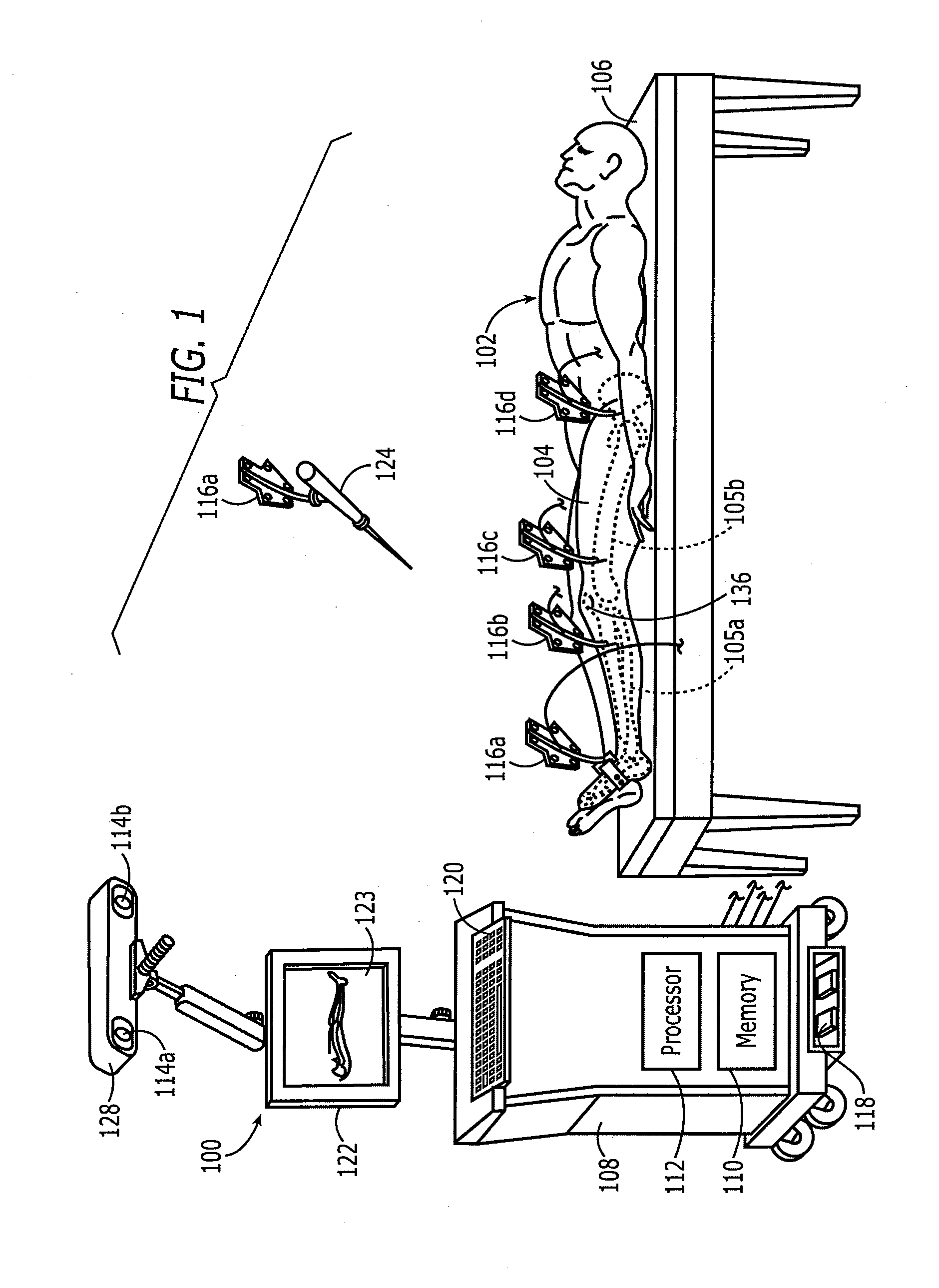 Method and apparatus for positioning a bone prosthesis using a localization system
