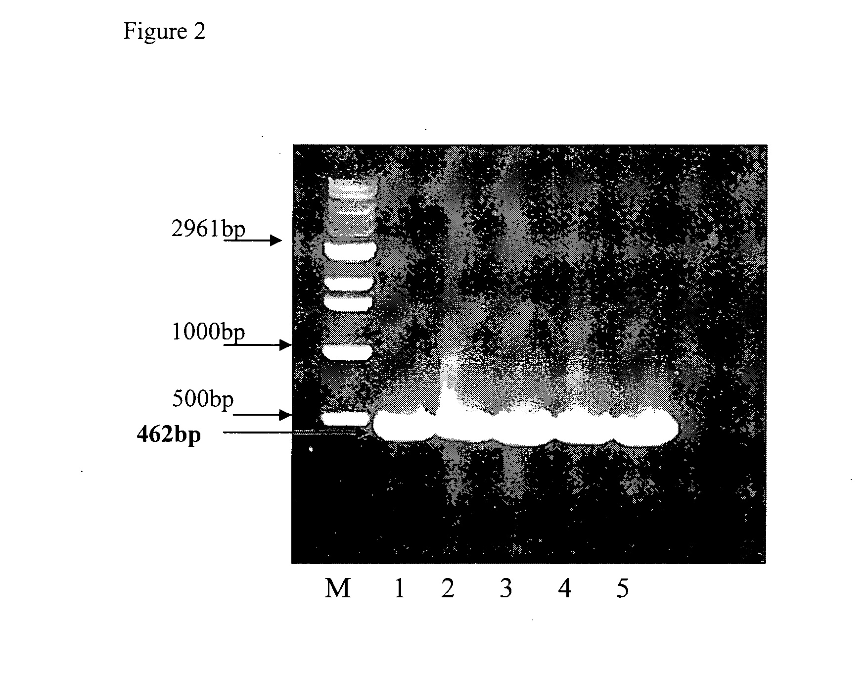 GLUTAMYL tRNA SYNTHETASE (GtS) FRAGMENTS