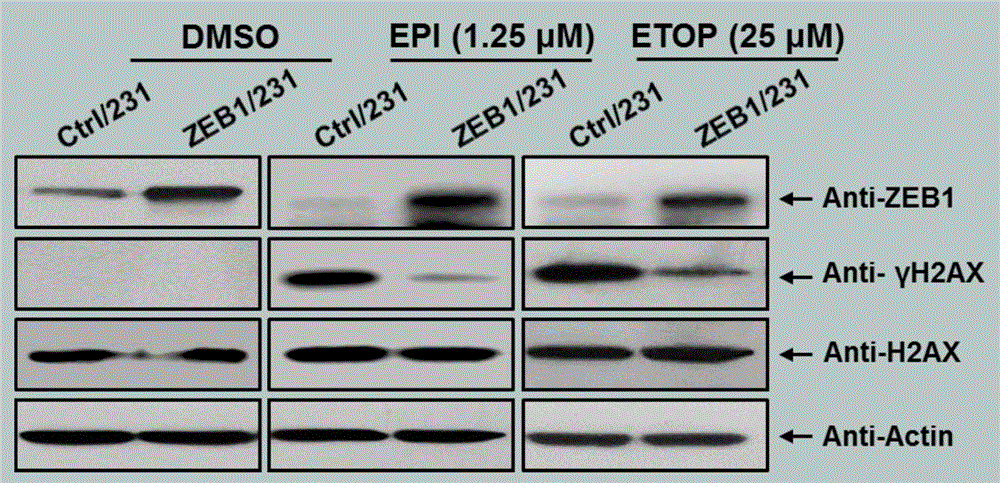 Application of transcription factor ZEB1 for preparing medicine capable of accelerating breast cancer chemosensitivity