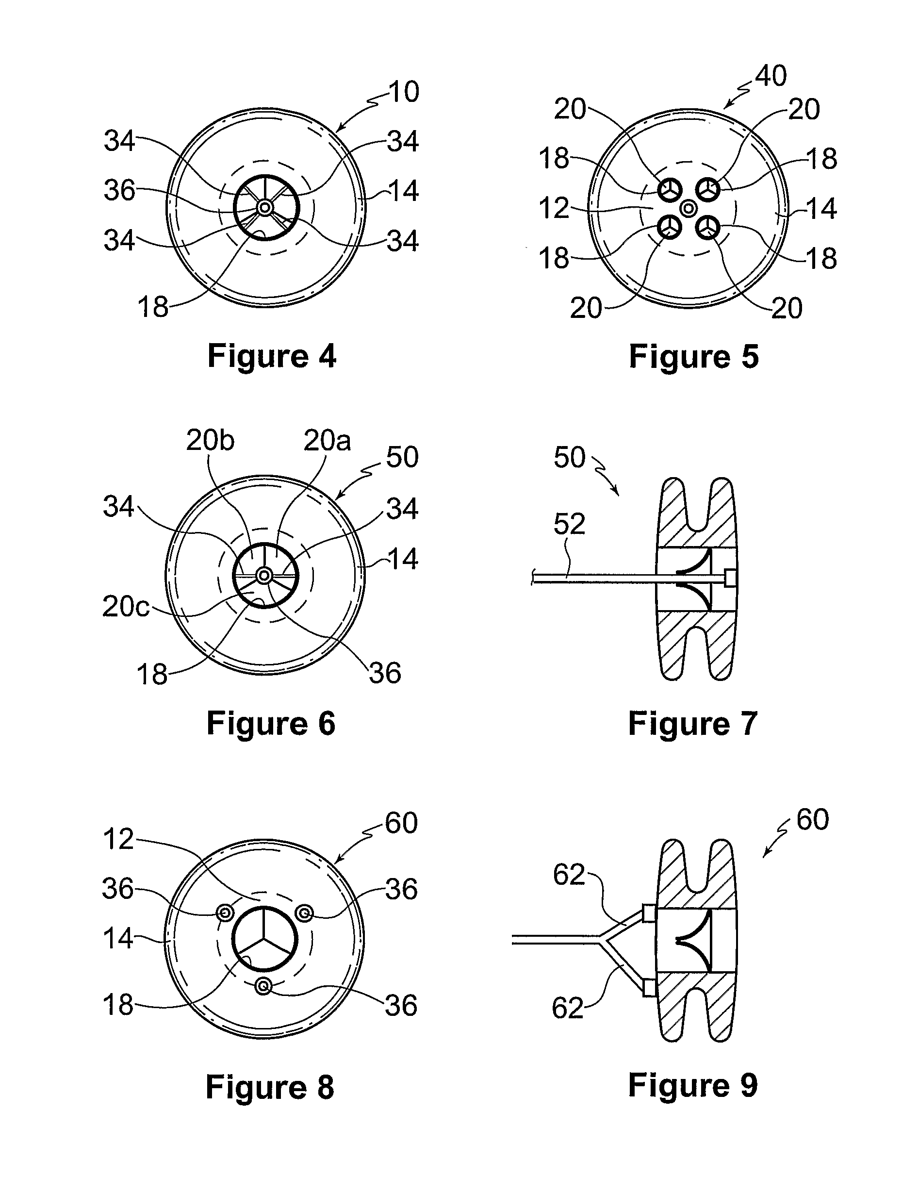 Devices and methods for the treatment of heart failure