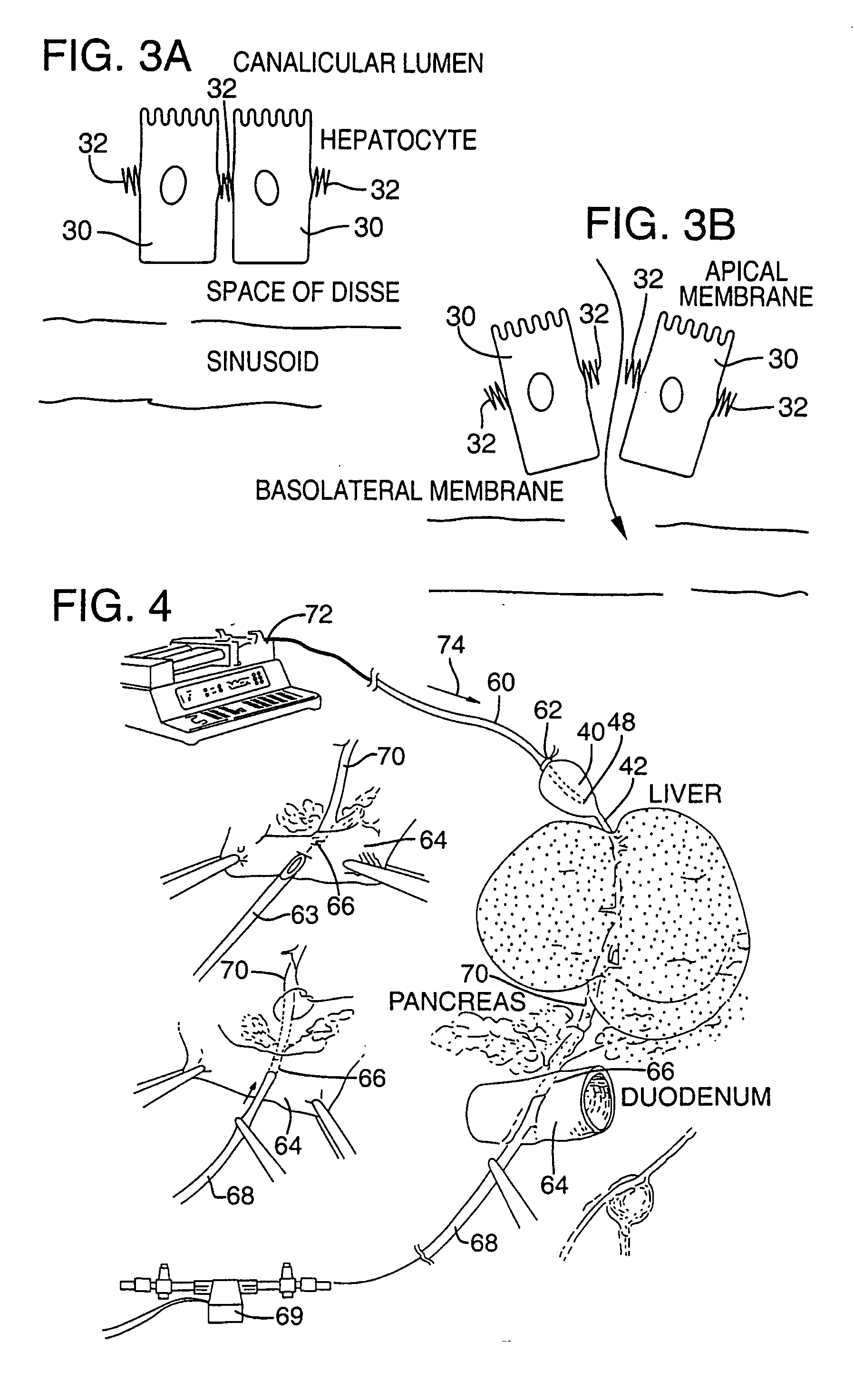 Method for pressure mediated selective delivery of therapeutic substances and cannula
