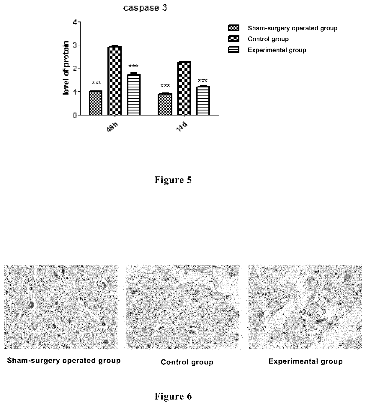 Use of a compound in repairing nerve injury