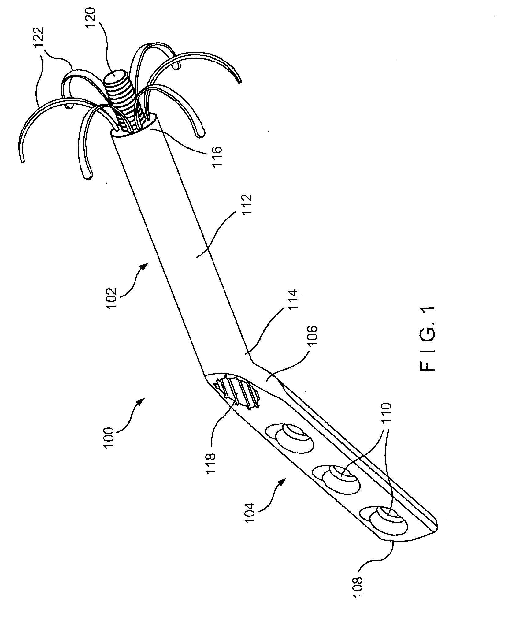 Humeral Head Fixation Device for Osteoporotic Bone