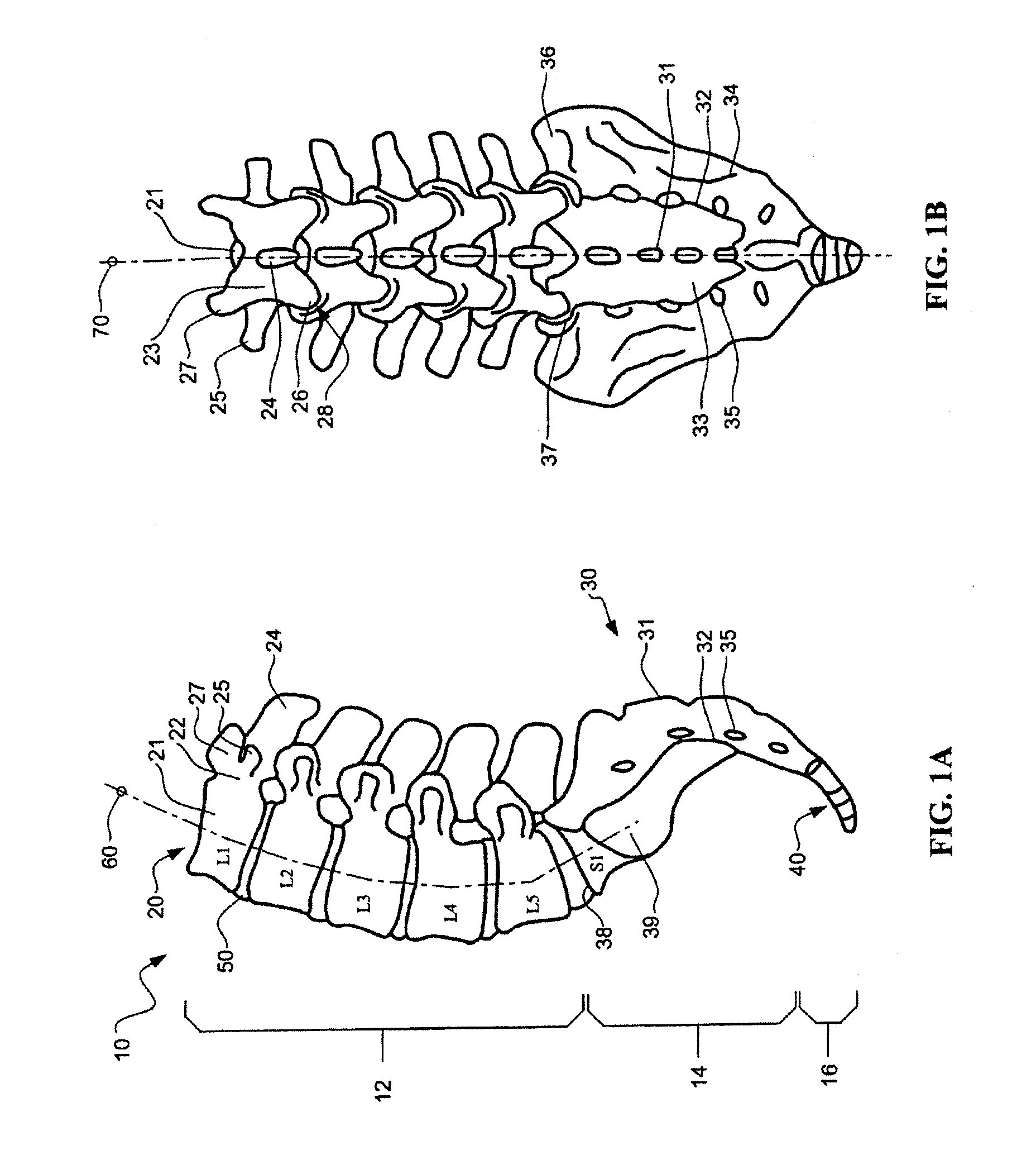 Devices and Methods for Annular Repair of Intervertebral Discs