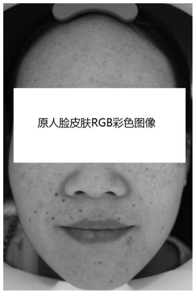 Extraction and regulation method of melanin and hemoglobin concentration in human face skin image