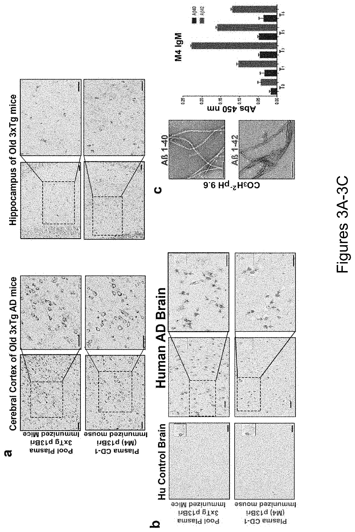 Specific murine and humanized monoclonal antibodies detecting pathology associated secondary structure changes in proteins and peptides