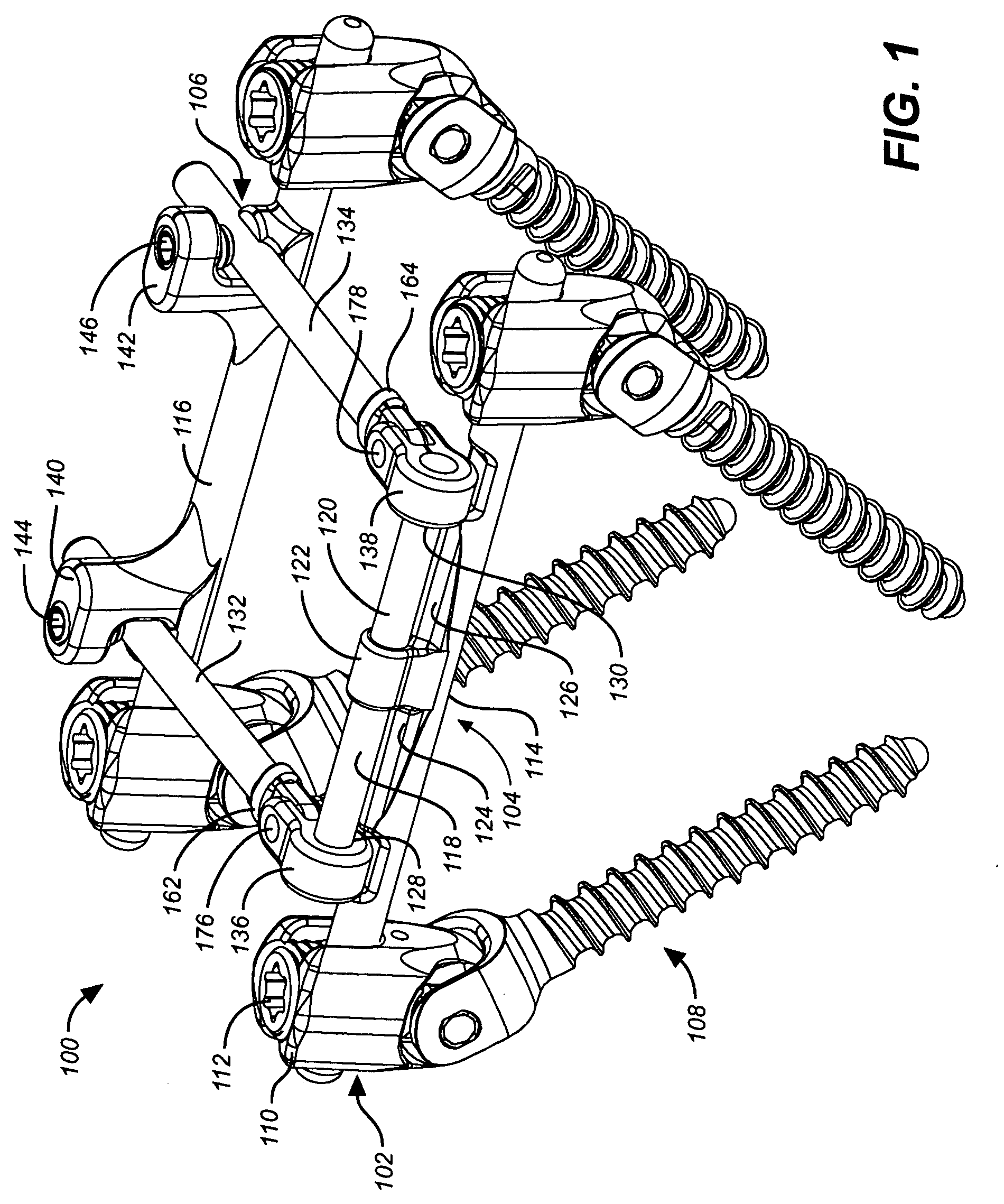 Deflection rod system with a deflection contouring shield for a spine implant and method