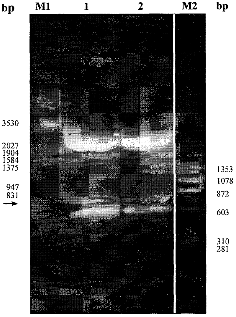 Specific antigen of clonorchis sinensis and application thereof