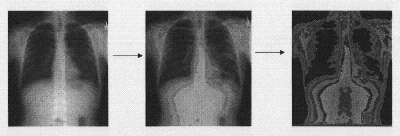 System for enhancing contrastive gray scale manipulation of medical image and realizing colorization