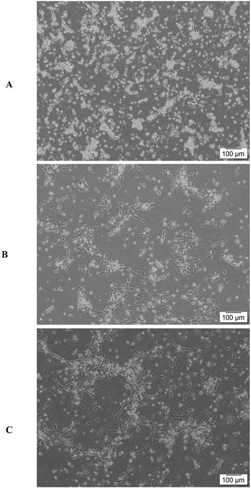 Separation culture method of laying duck small yellow follicle granular cells