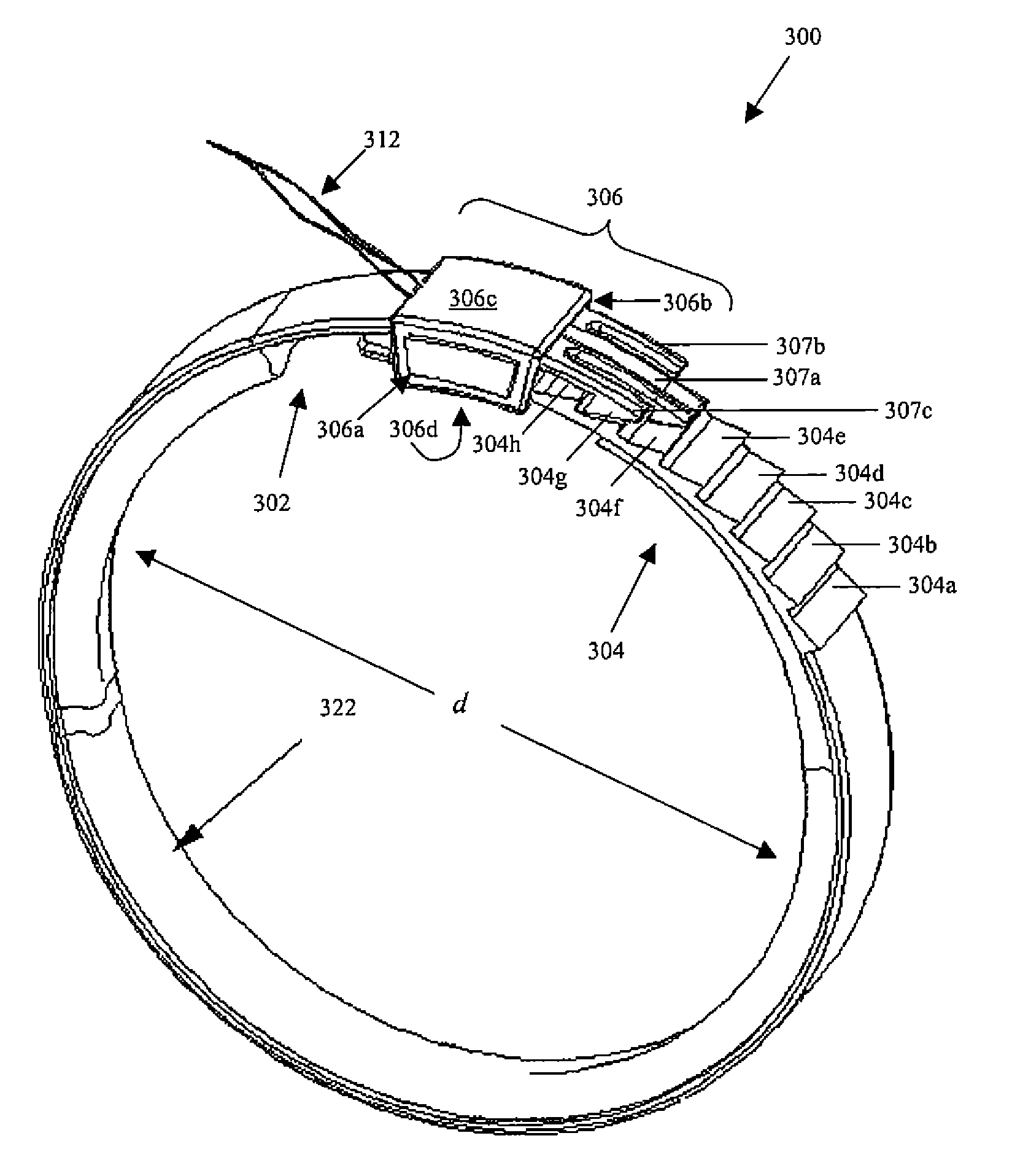 Electroactive polymer actuated gastric band