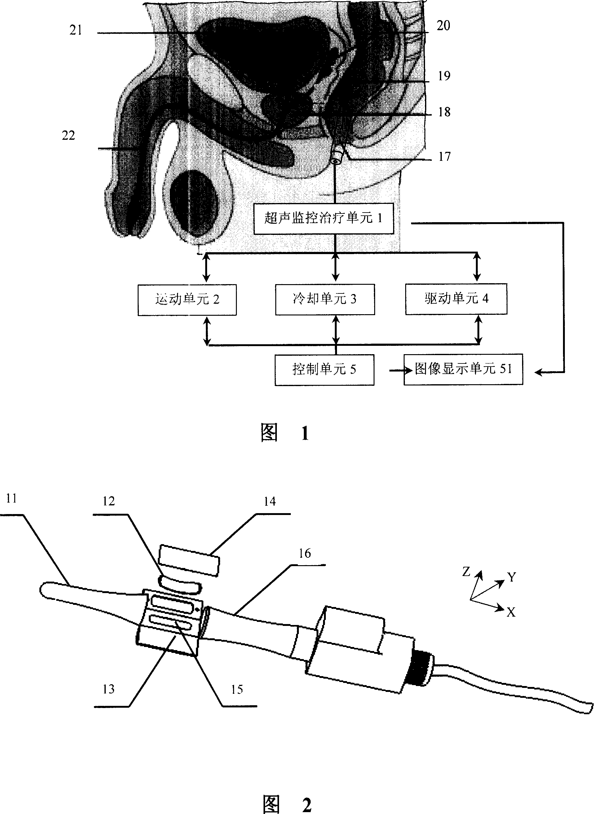 Ultrasonic device for treating prostate disease