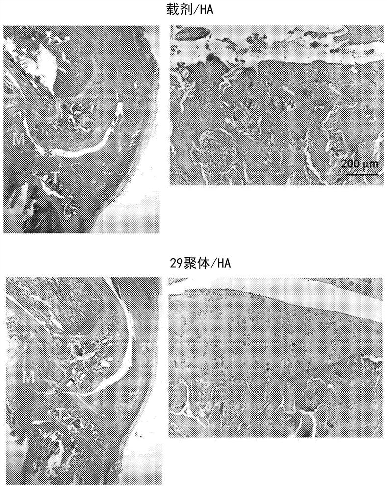 Application of pedf-derived short peptides in the treatment of osteoarthritis