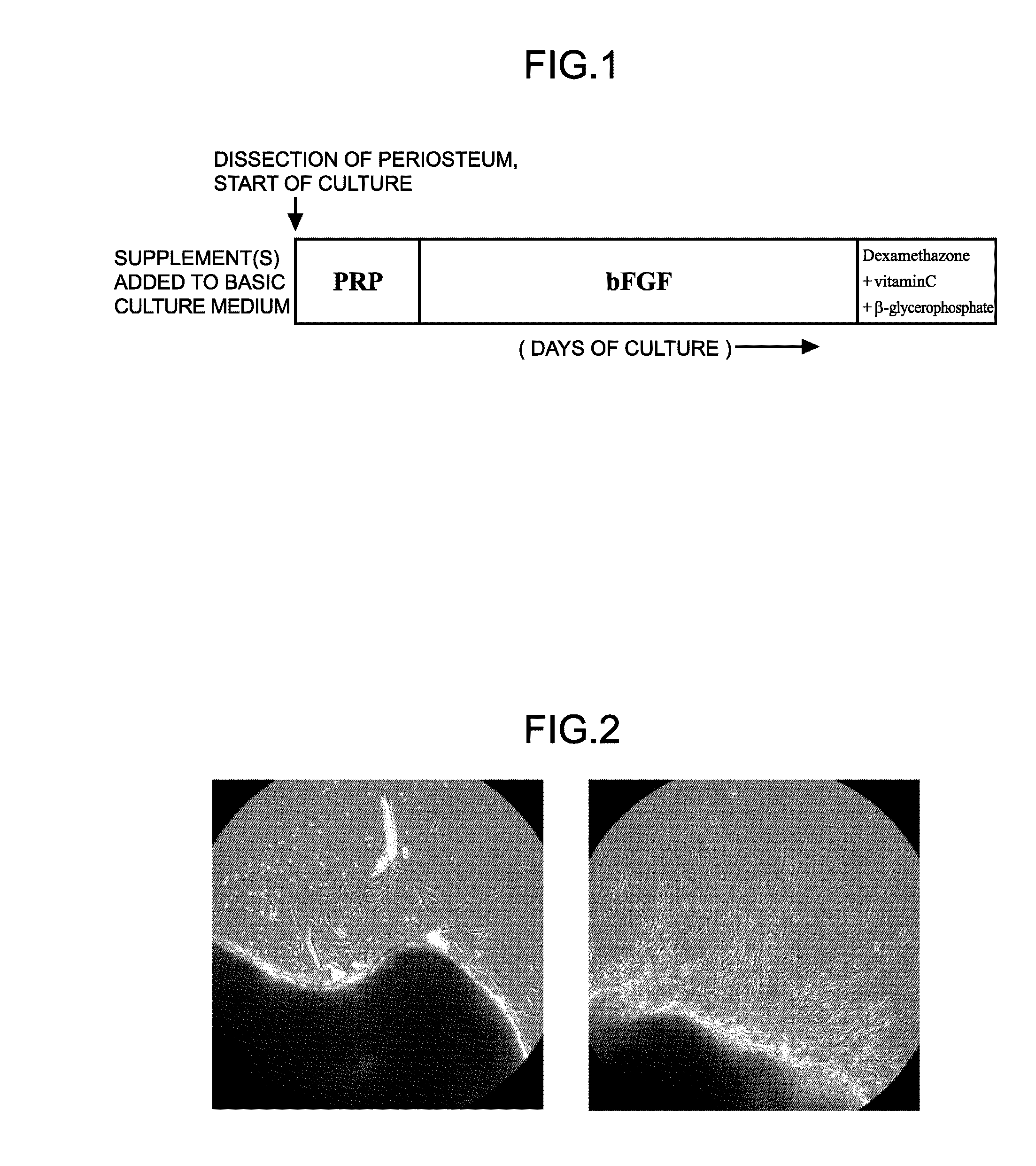 Method for culturing human periosteum