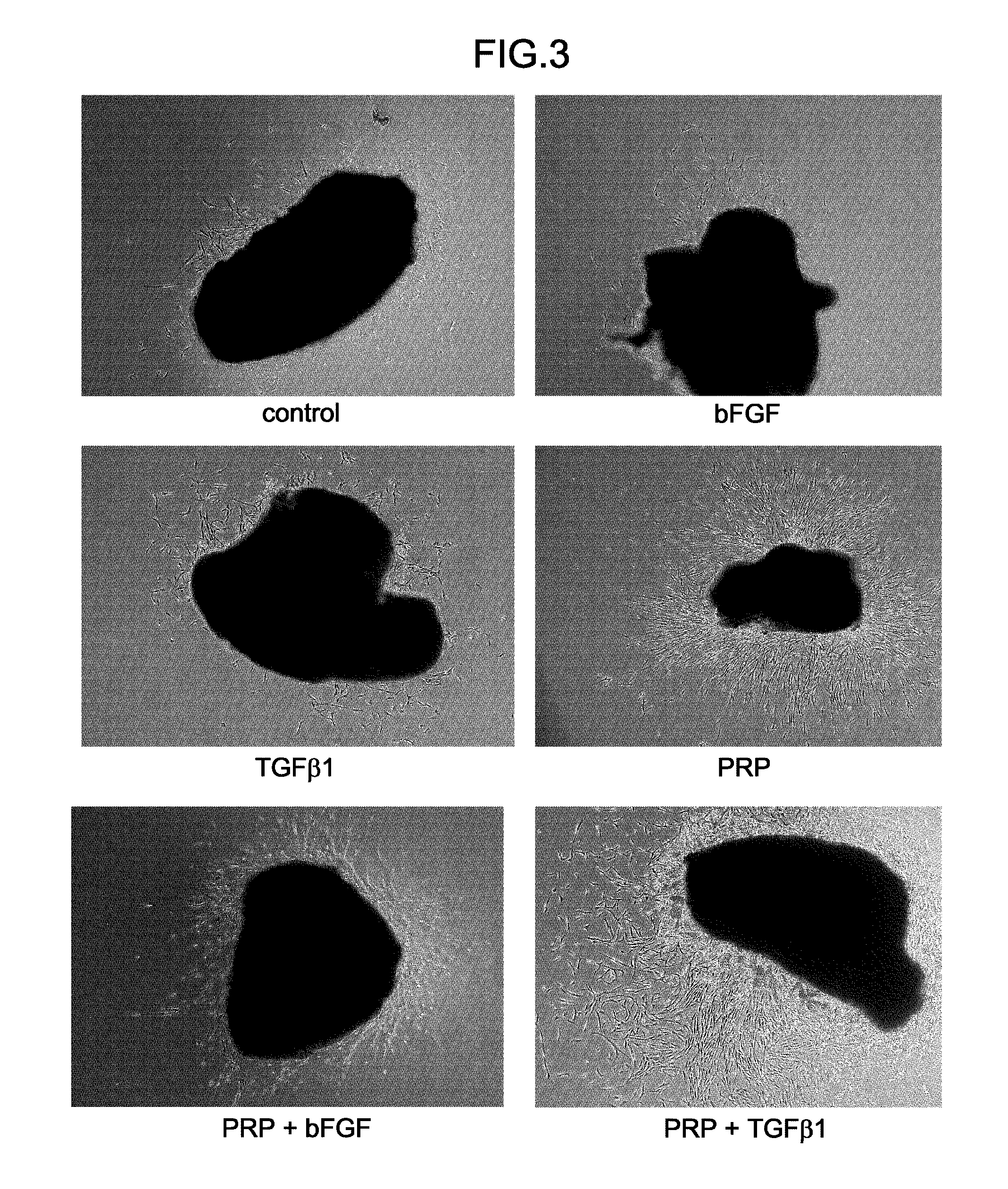 Method for culturing human periosteum