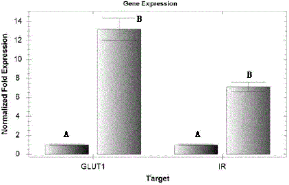 Human hematopoietic stem cell expressing human exogenous proinsulin and application thereof