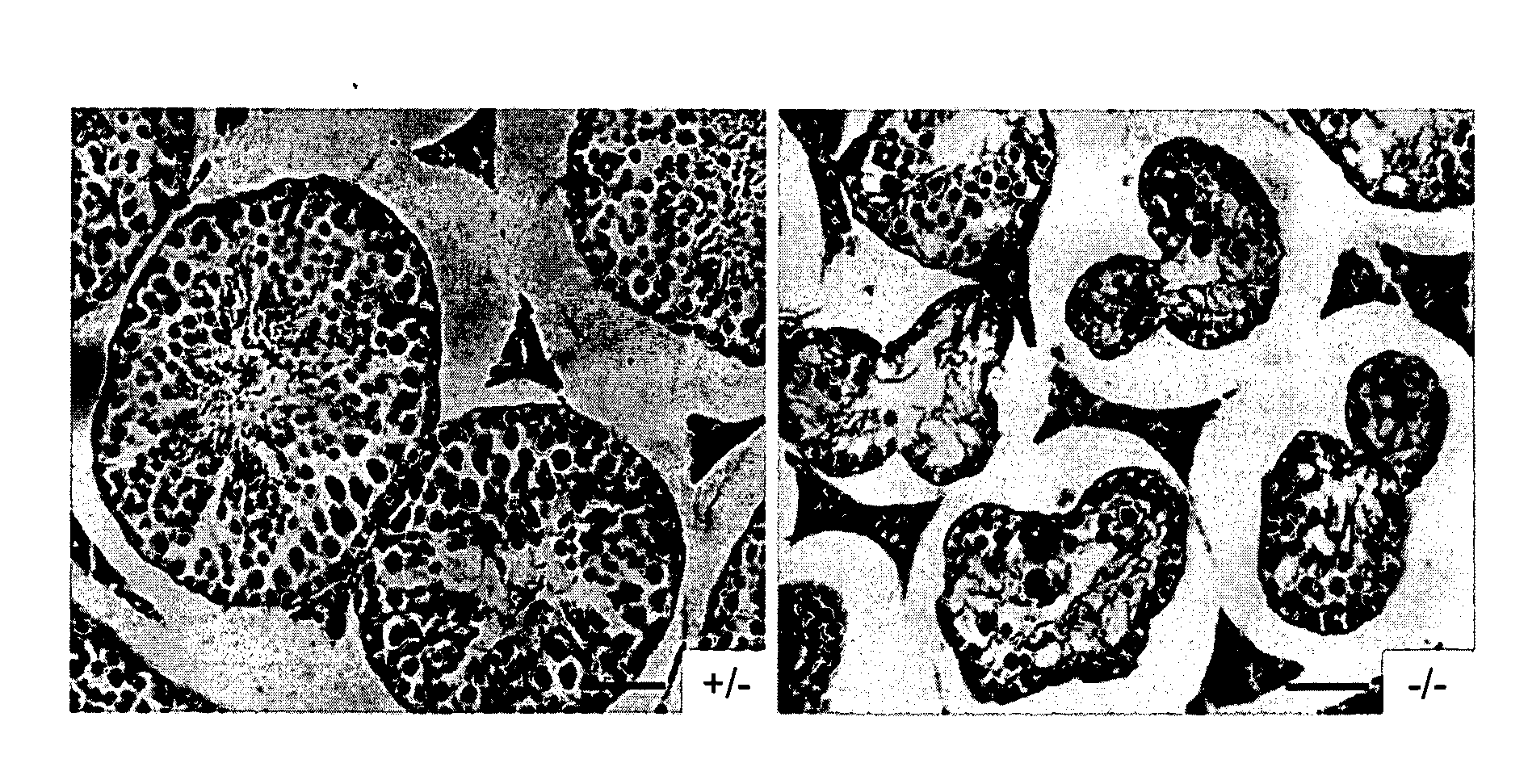 Ant4 inhibitor compounds and methods of use thereof