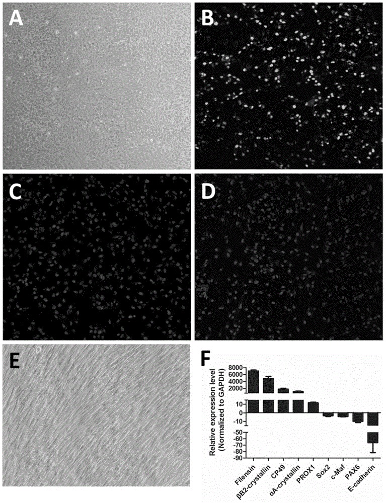A separation culture method for lens epithelium stem cells