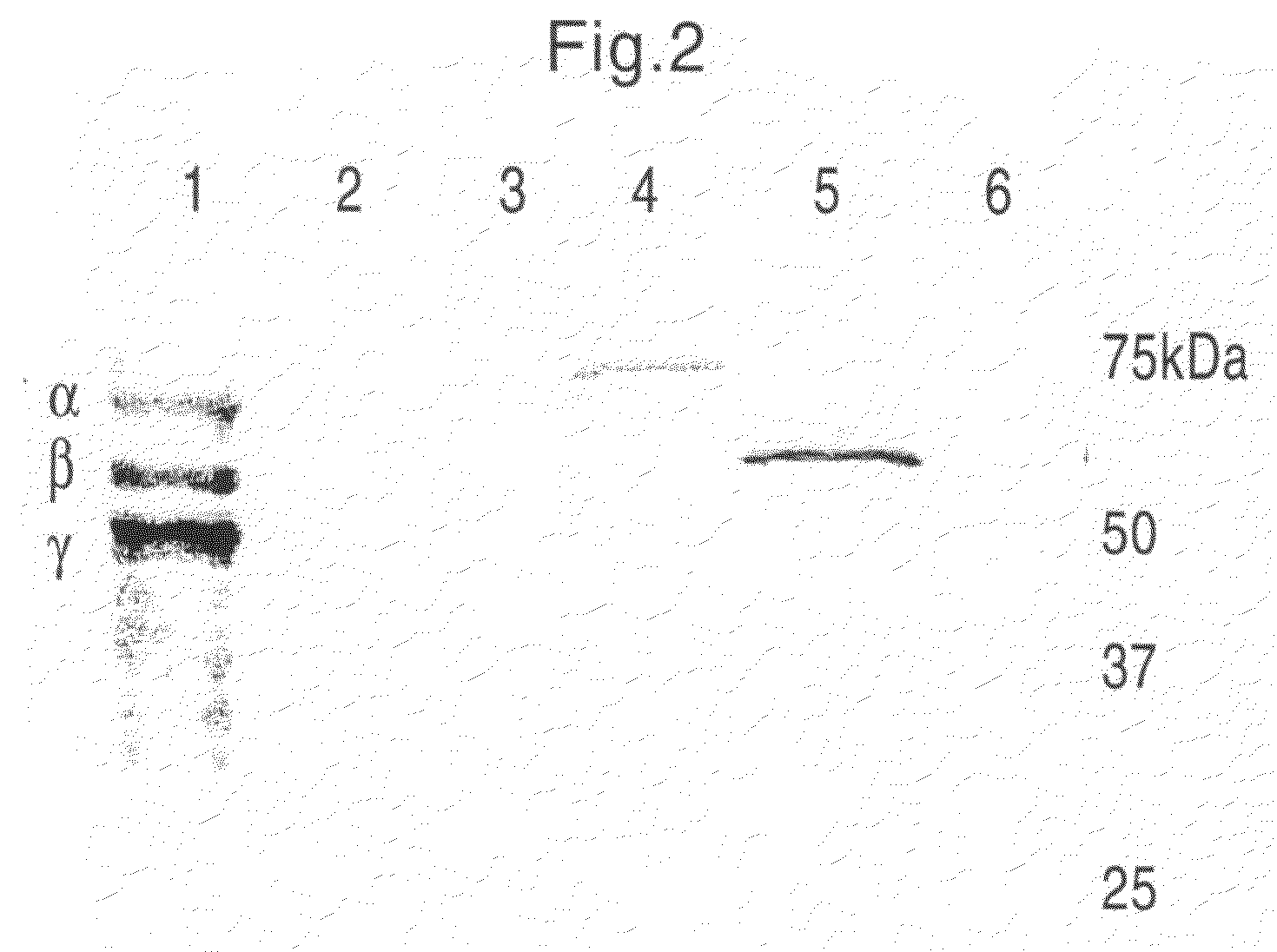 Human Blood Proteins Expressed in Monocot Seeds