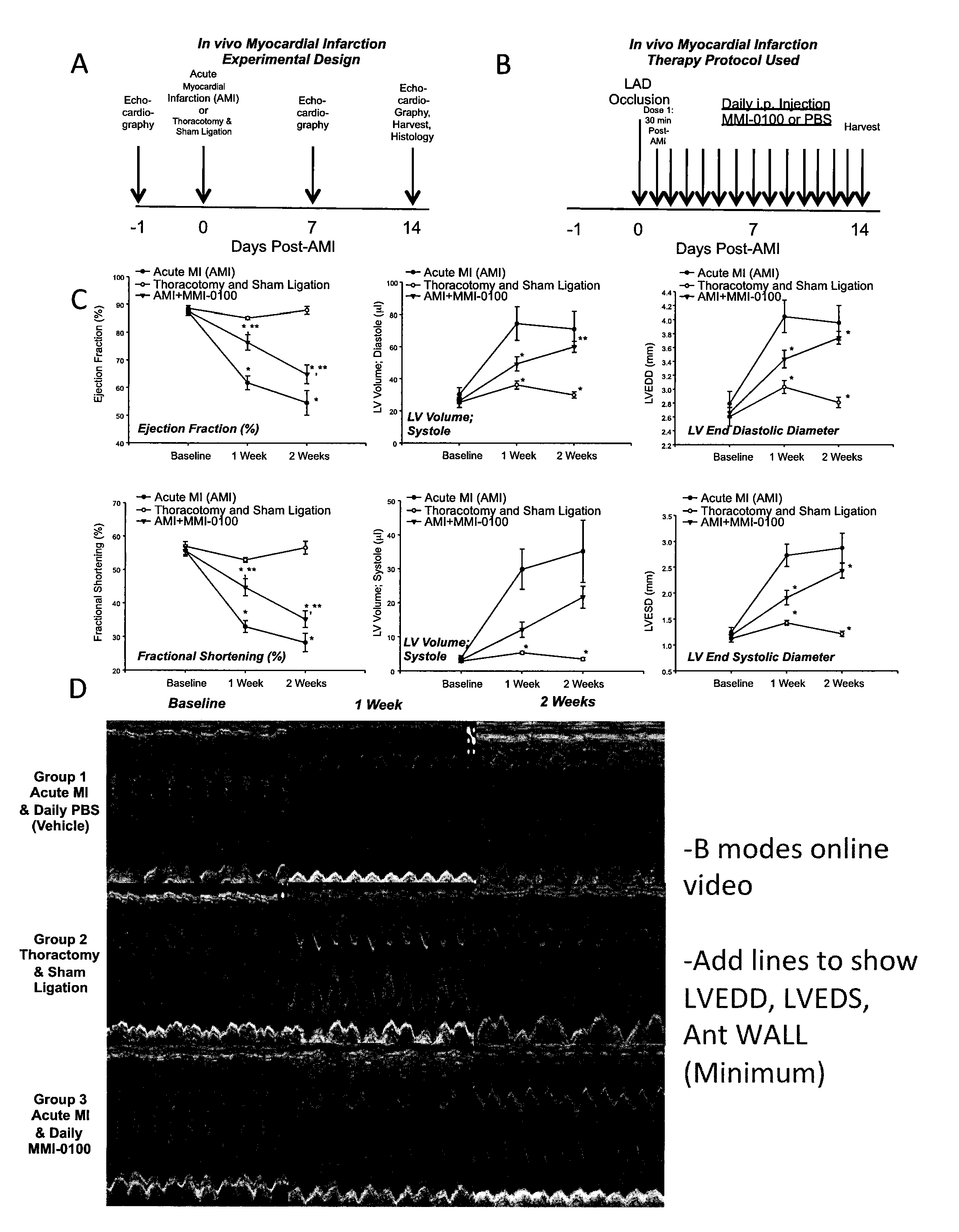 Inhibition of cardiac fibrosis in myocardial infarction