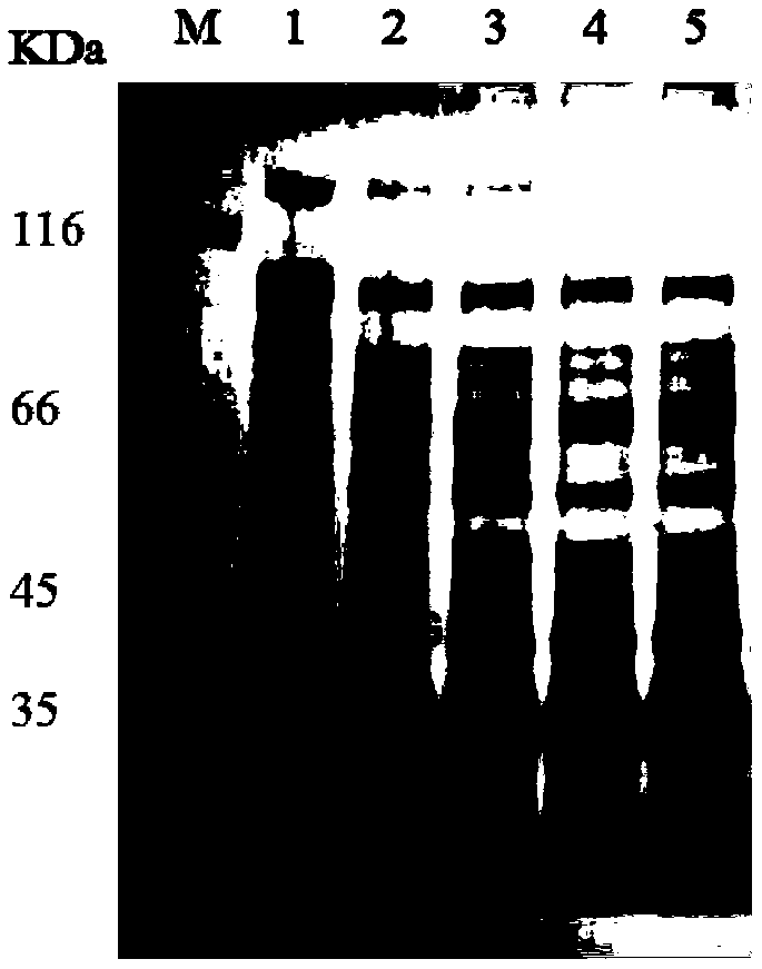 Autophagy related protein molecule ATG5 of rhipicephalus haemaphysaloides and application thereof