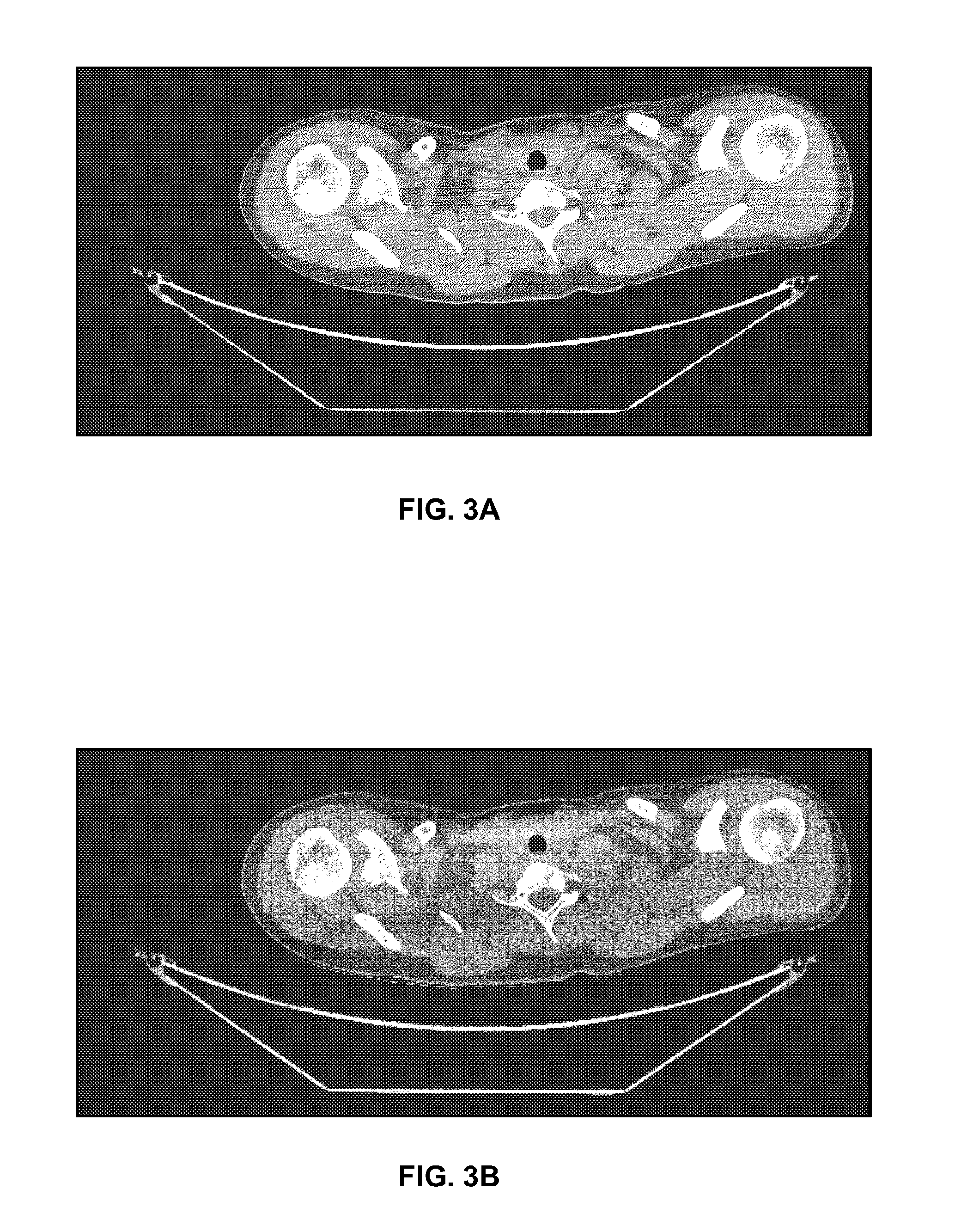Methods and systems to facilitate correcting gain fluctuations in iterative image reconstruction