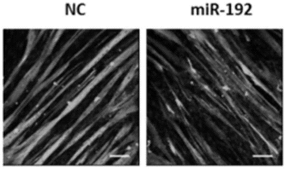 Application of miR-192 in regulation and control of proliferation and differentiation of sheep skeletal muscle satellite cells