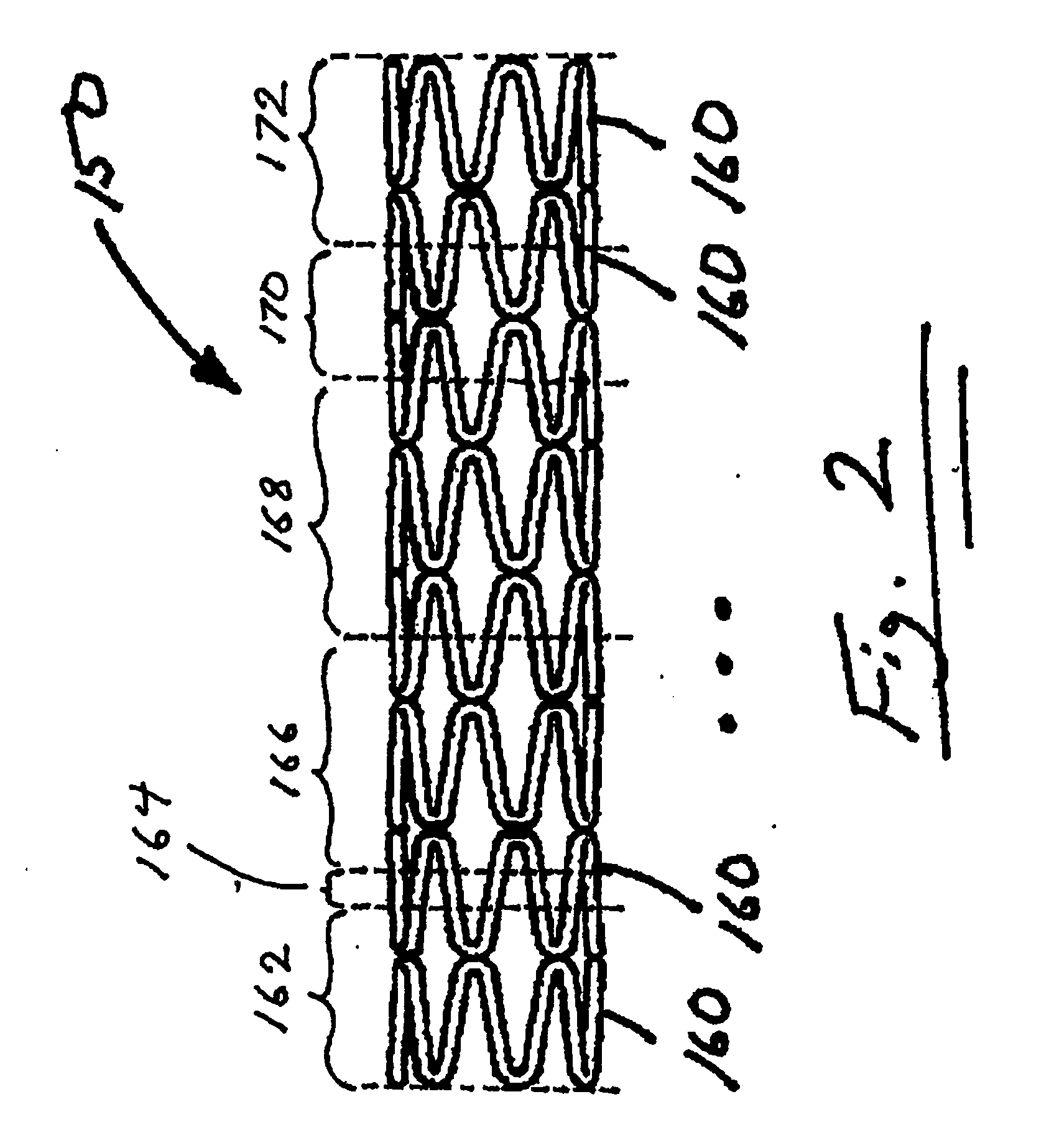 Stent with intermittent coating