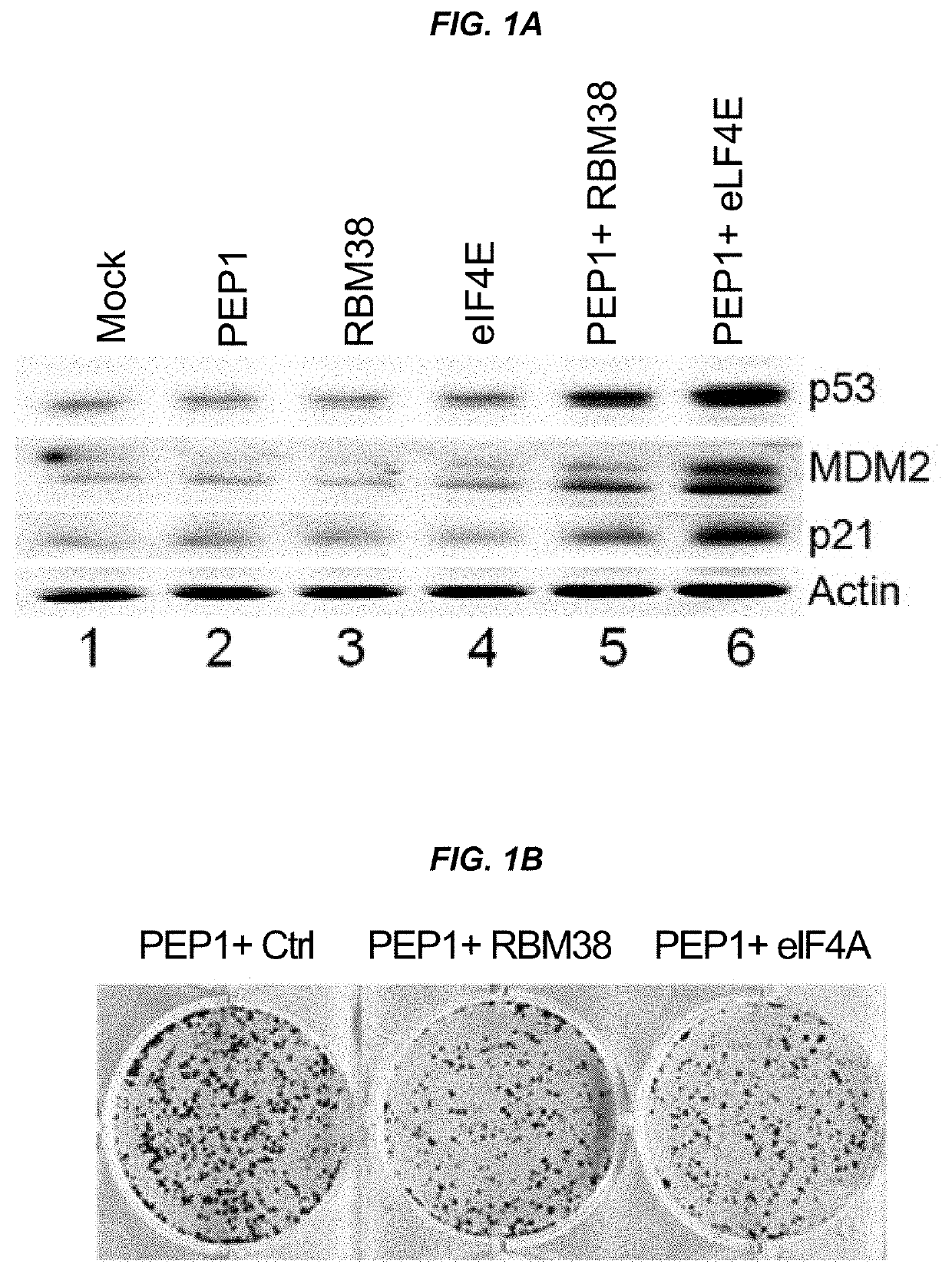 Modulation of P53 for the treatment of cancer