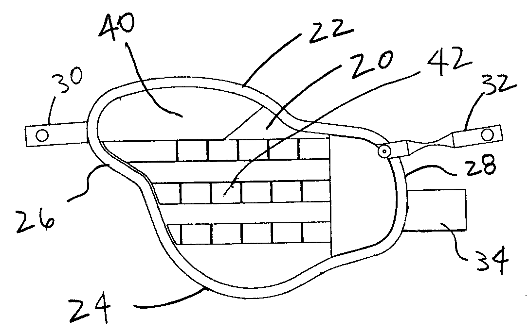 Deltoid arm protection system for ballistic body armor