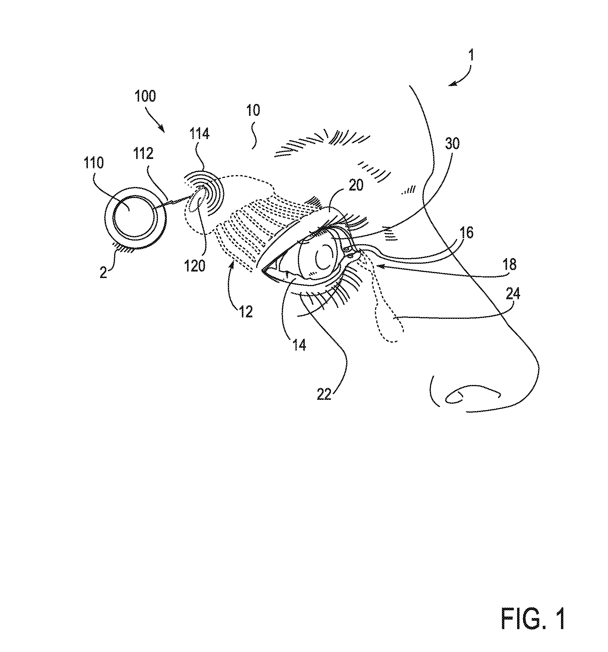 Systems and methods for treatment of dry eye