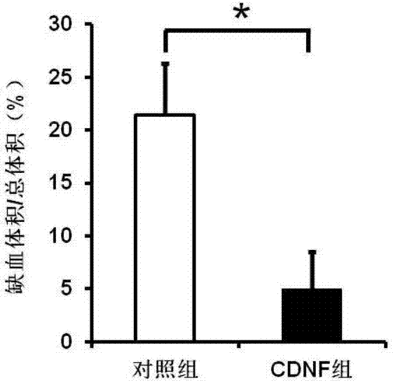 Application of CDNF (cerebral dopamine neurotrophic factor) in preparation of ischemic cerebrovascular disease drugs
