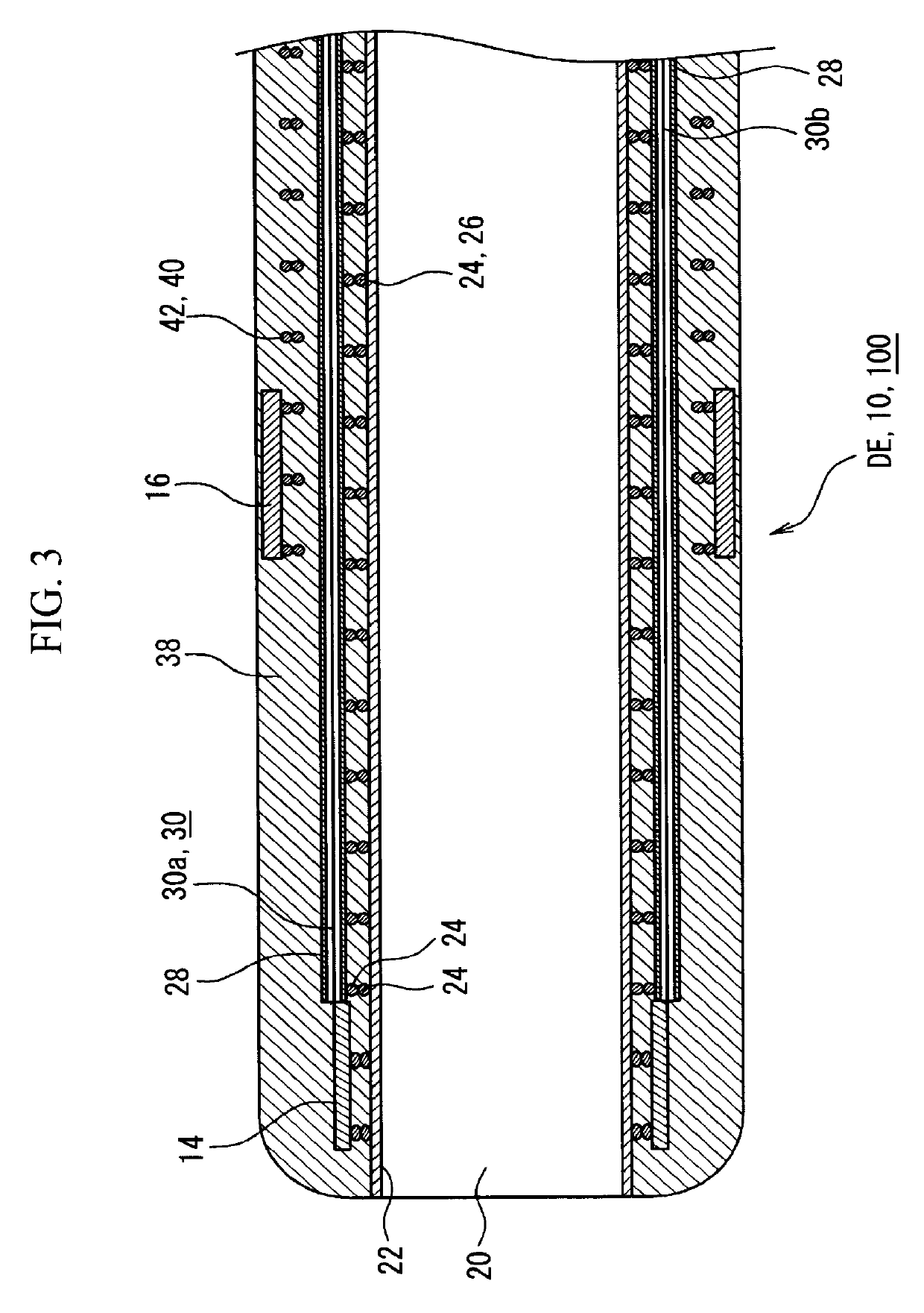 Catheter, catheter manipulation part, and catheter manufacturing method