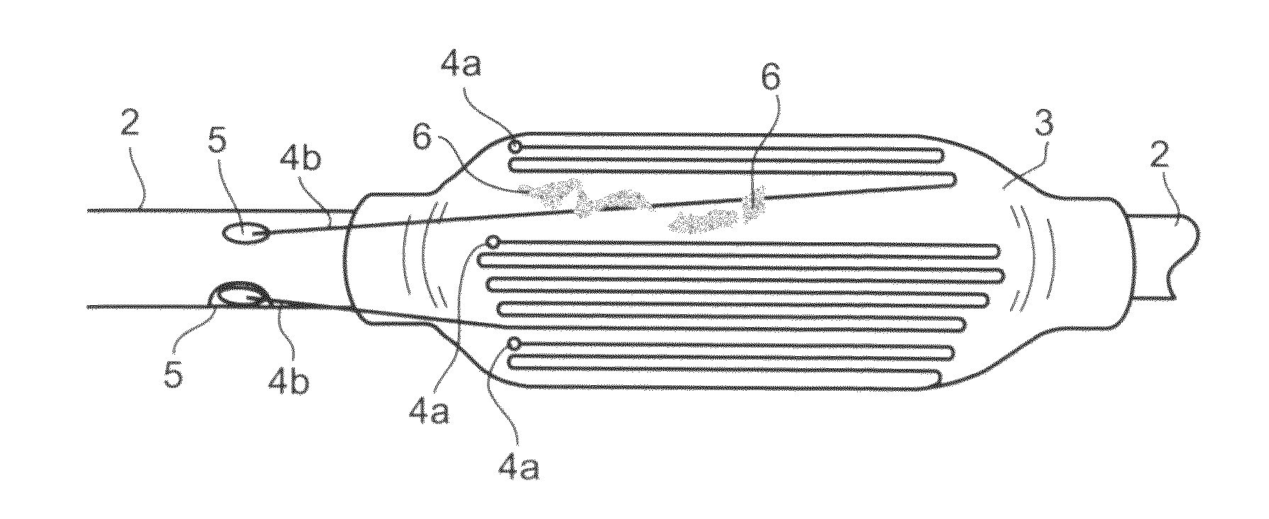 Apparatus and method for removing deposits from tubular structure, particularly atheroma from blood vessels