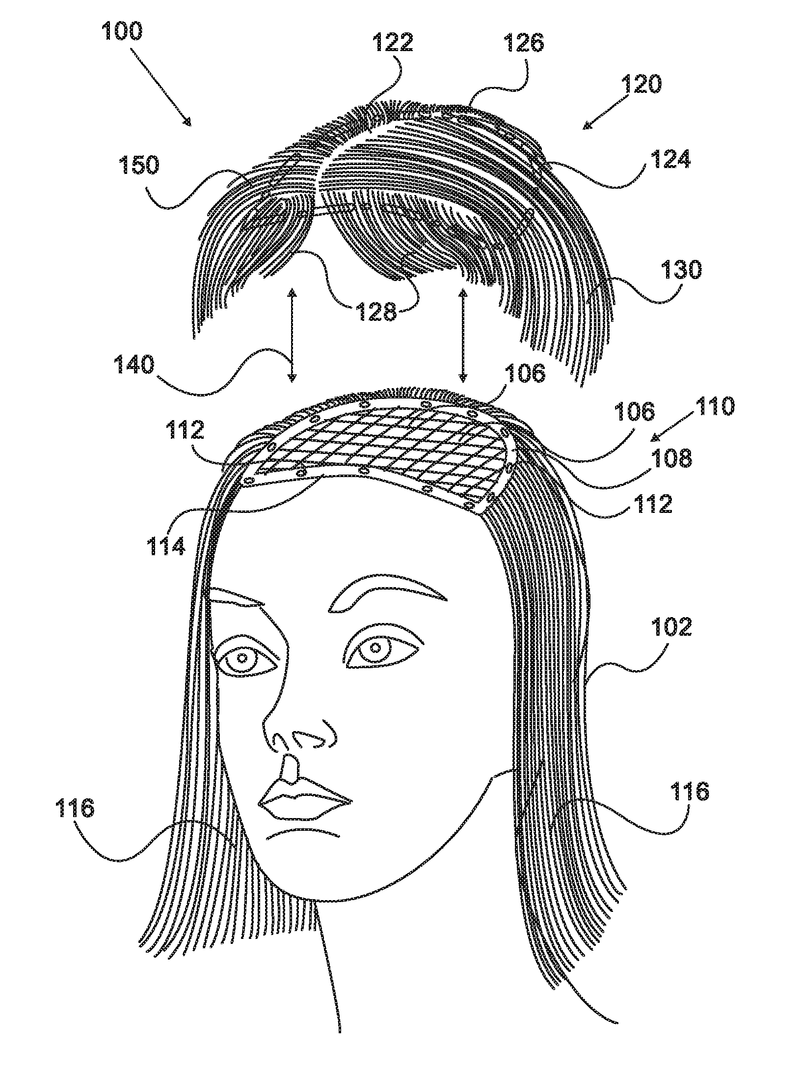 Detachable wig arrangement and method