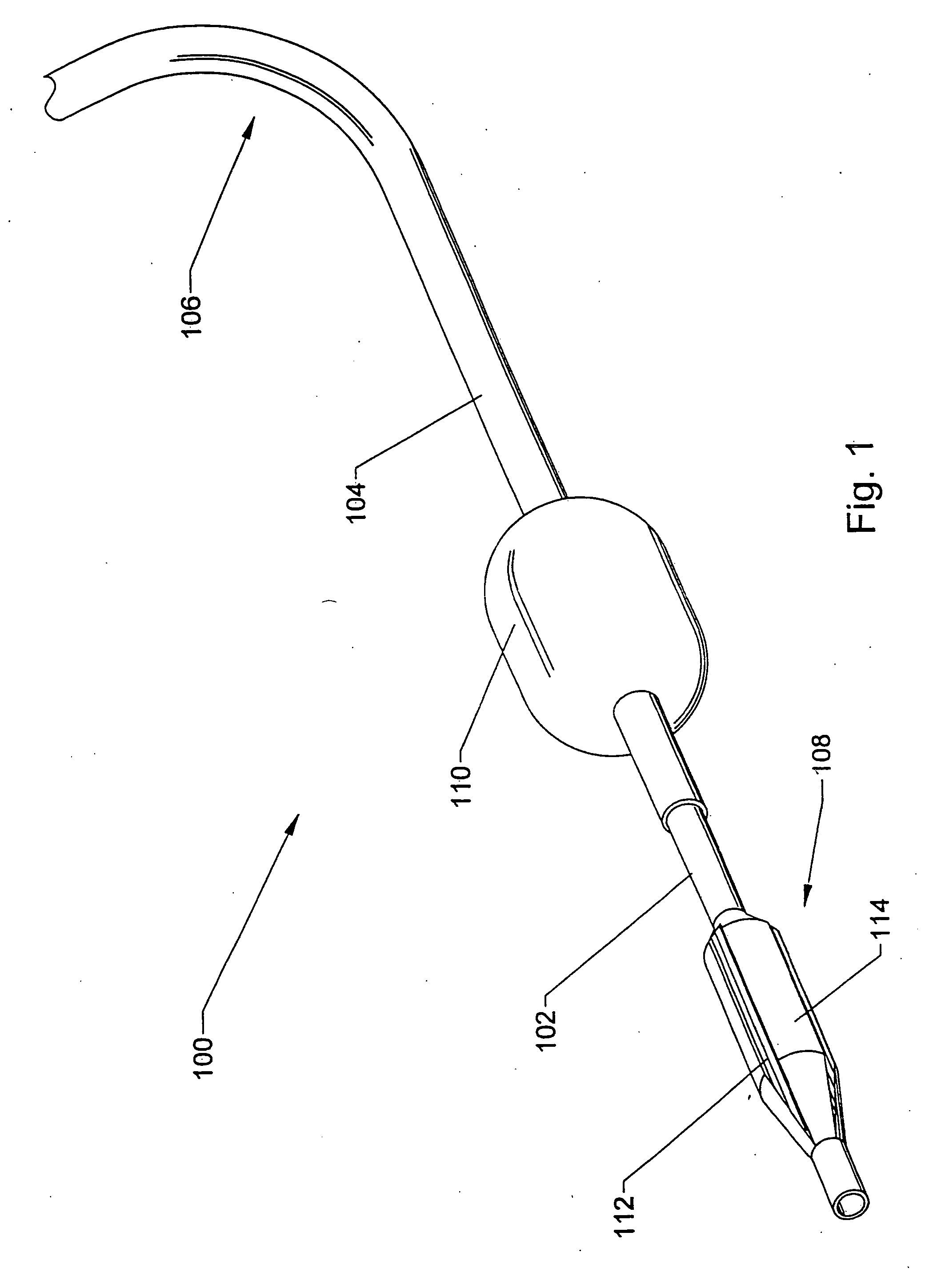 Methods using a dual balloon telescoping guiding catheter