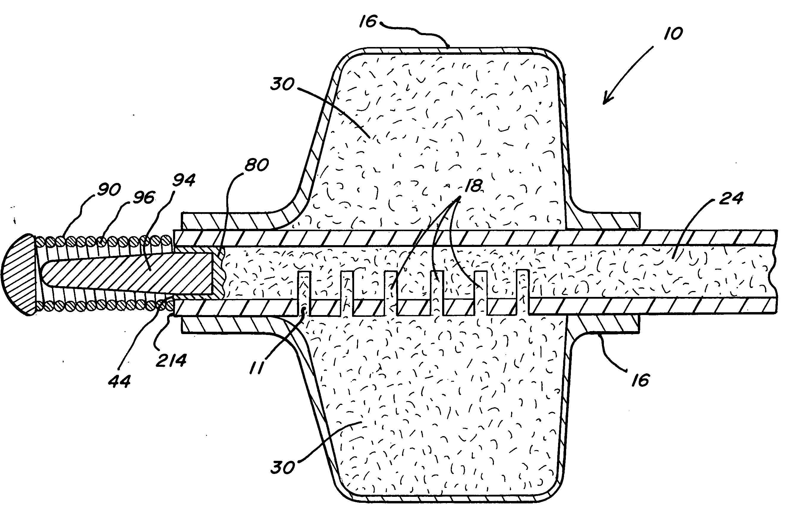 Occluding guidewire and methods