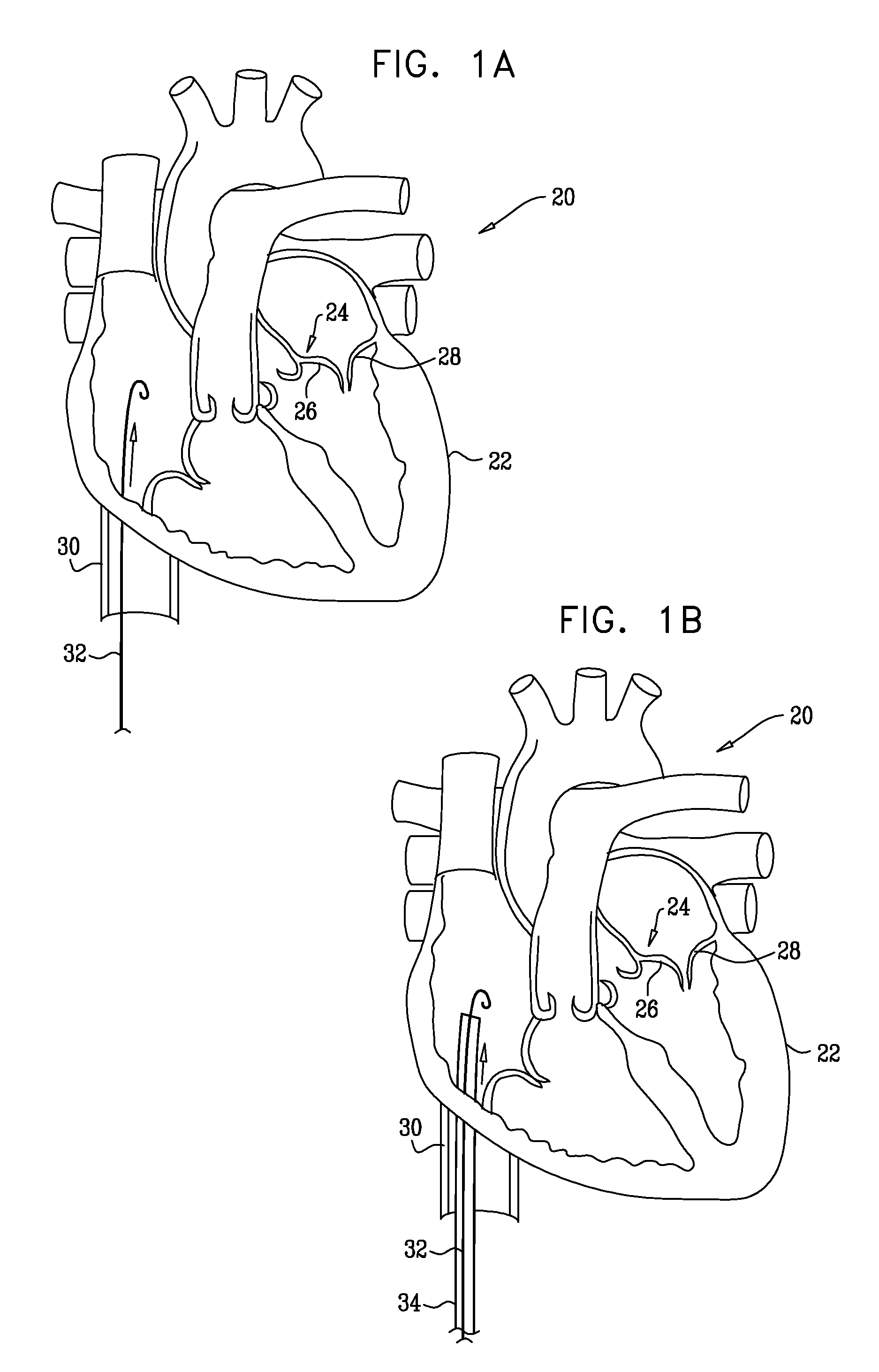 Tissue anchor for annuloplasty device