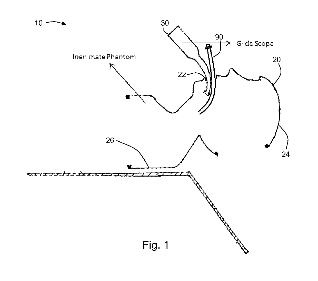 Intubation simulator and method