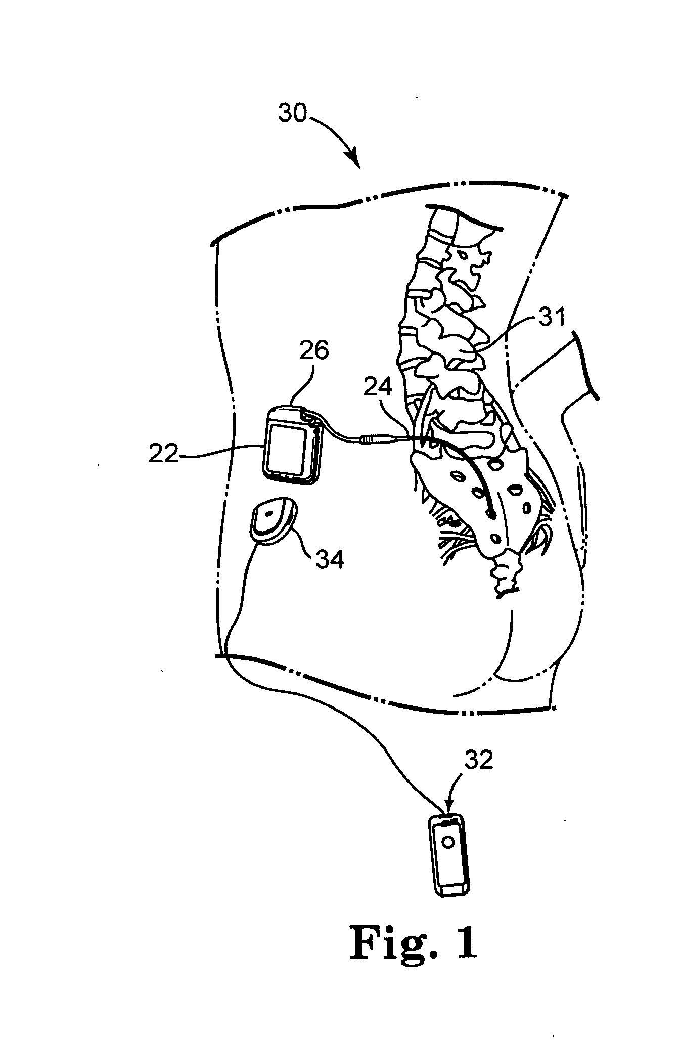 Controller for obtaining prescriptive analysis of functionality of implantable medical device leads, system and method therefore