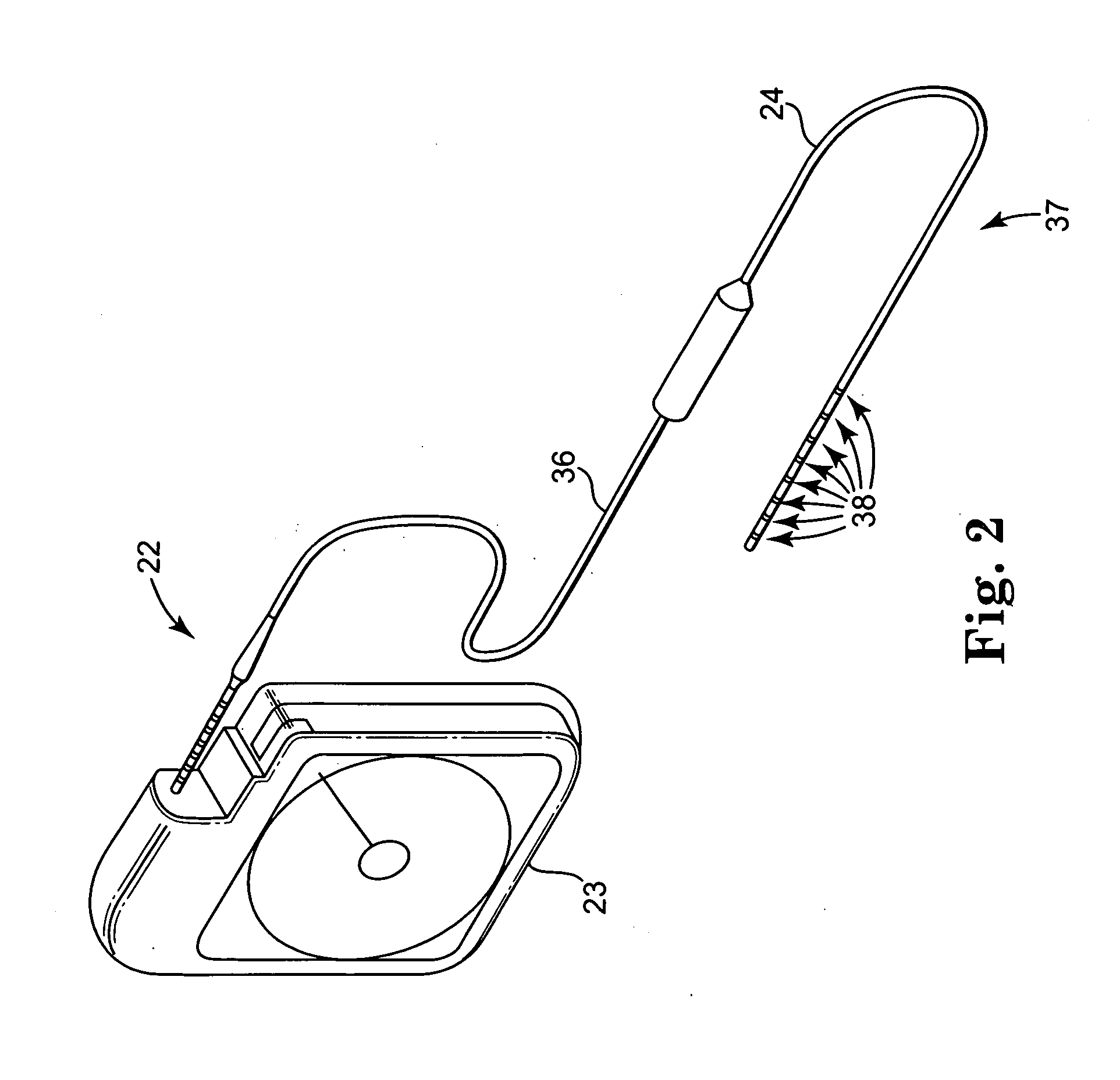 Controller for obtaining prescriptive analysis of functionality of implantable medical device leads, system and method therefore