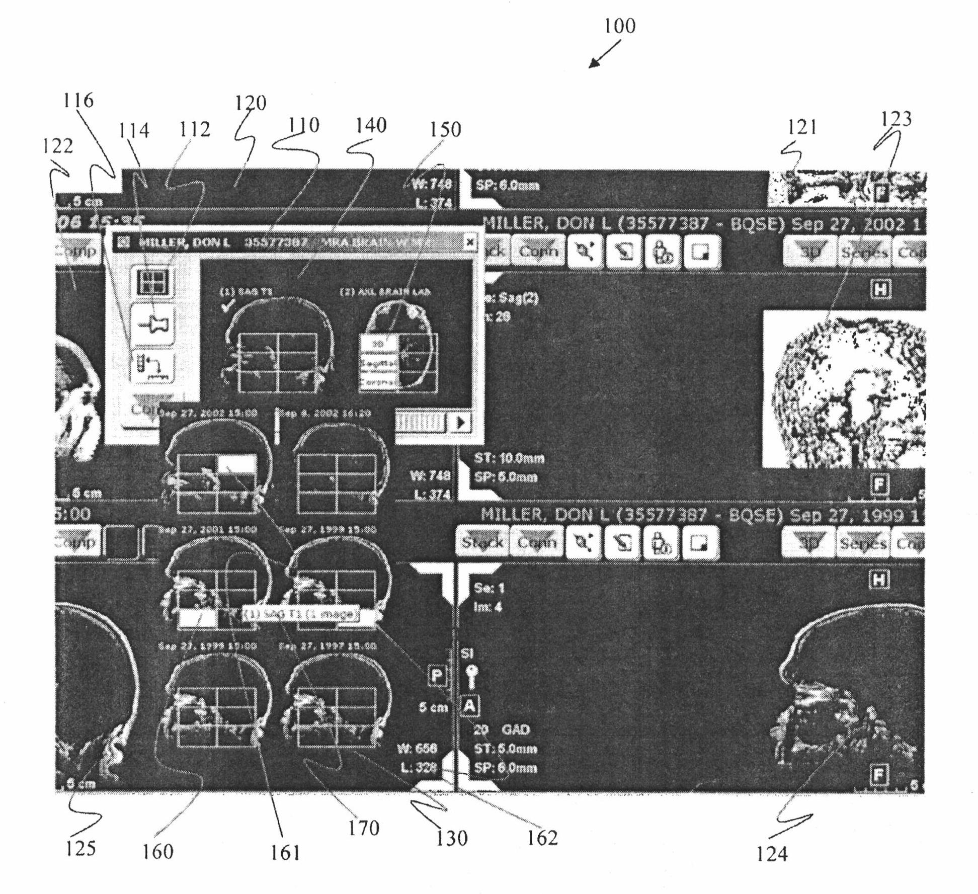 Systems and methods for applying series level operations and comparing images using a thumbnail navigator