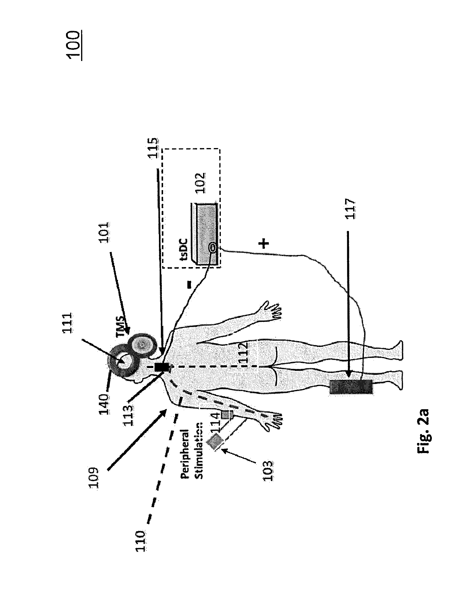 Method and system for treatment of mobility dysfunction