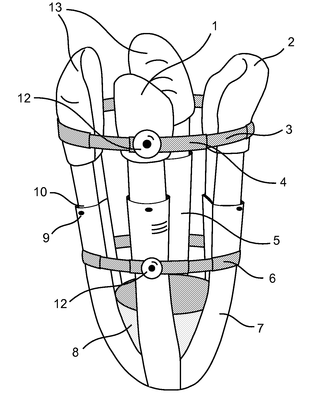 Modular prosthetic sockets and methods for making same