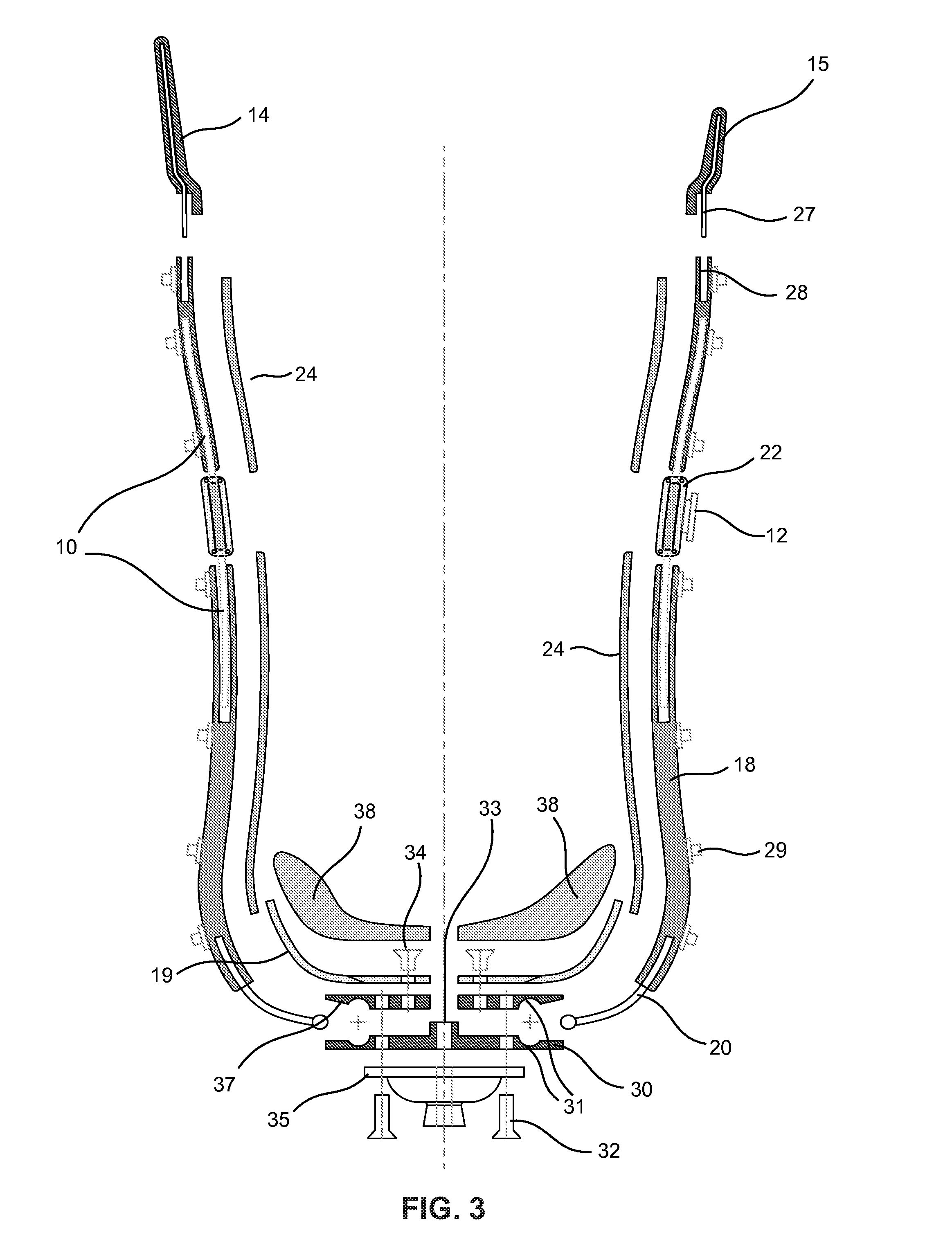 Modular prosthetic sockets and methods for making same