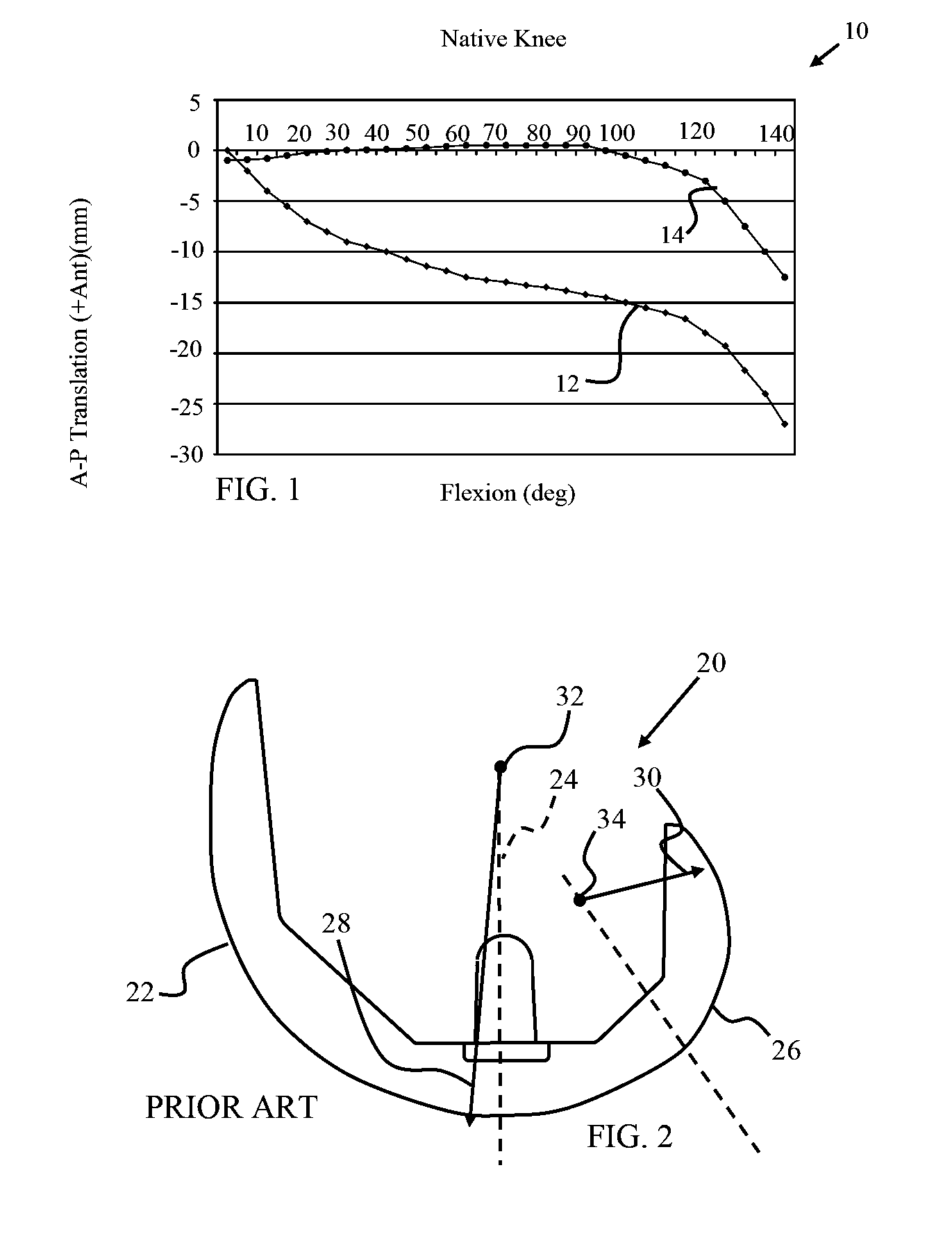 Antero-posterior placement of axis of rotation for a rotating platform