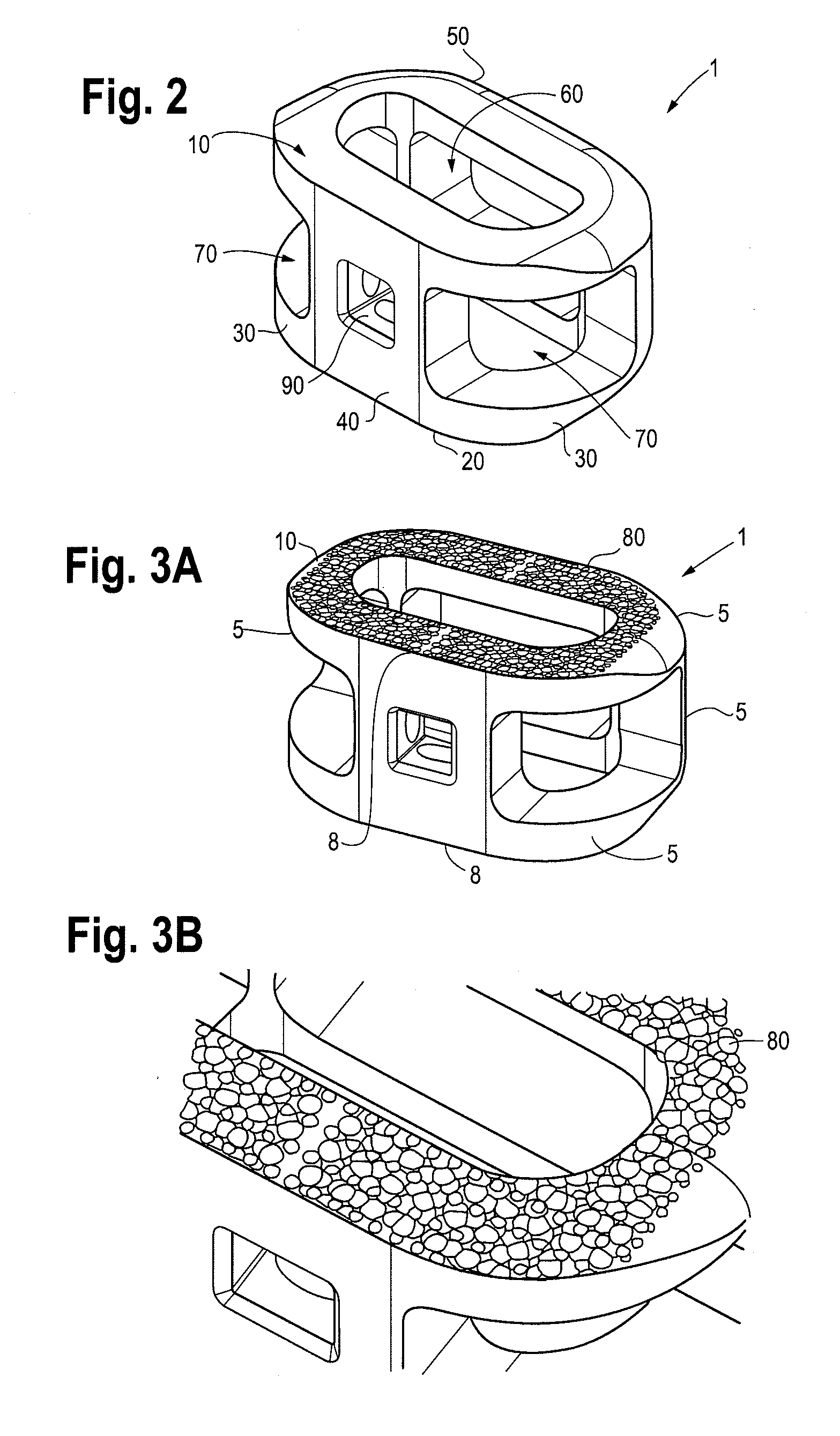 Microstructured implant surfaces