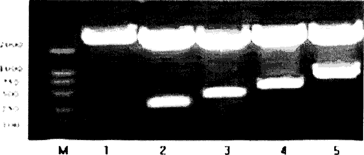 Recombined T4 bacteriophage of expressing cholecystokinin gene