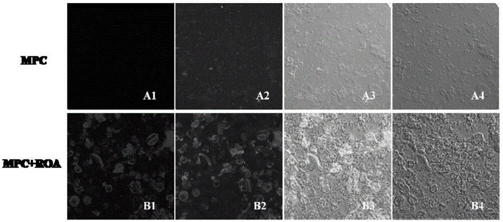 Method for improving solubility of concentrated protein powder by means of fatty acid combination or by removing calcium in casein micelle