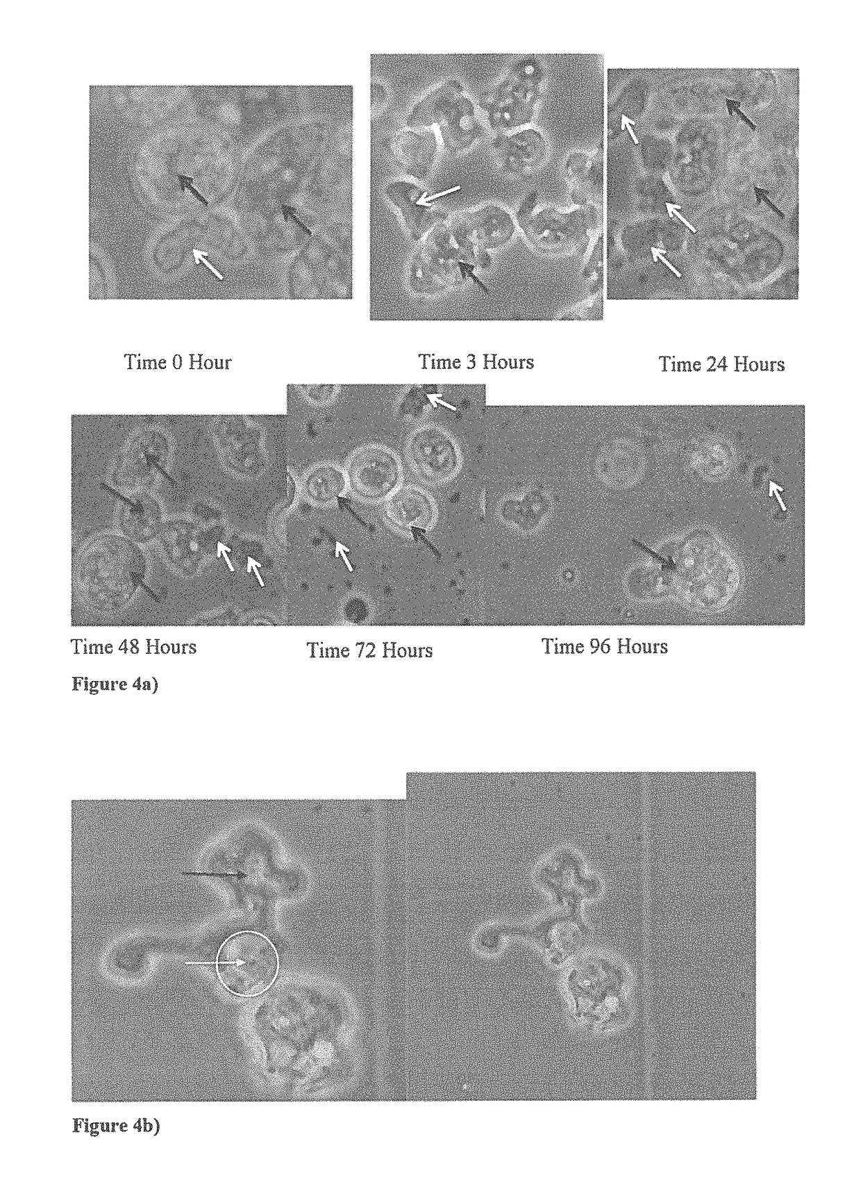 Method for biologically combating <i>Naegleria fowleri</i>, and disinfecting agent containing protozoa of the species <i>Willaertia magna </i>